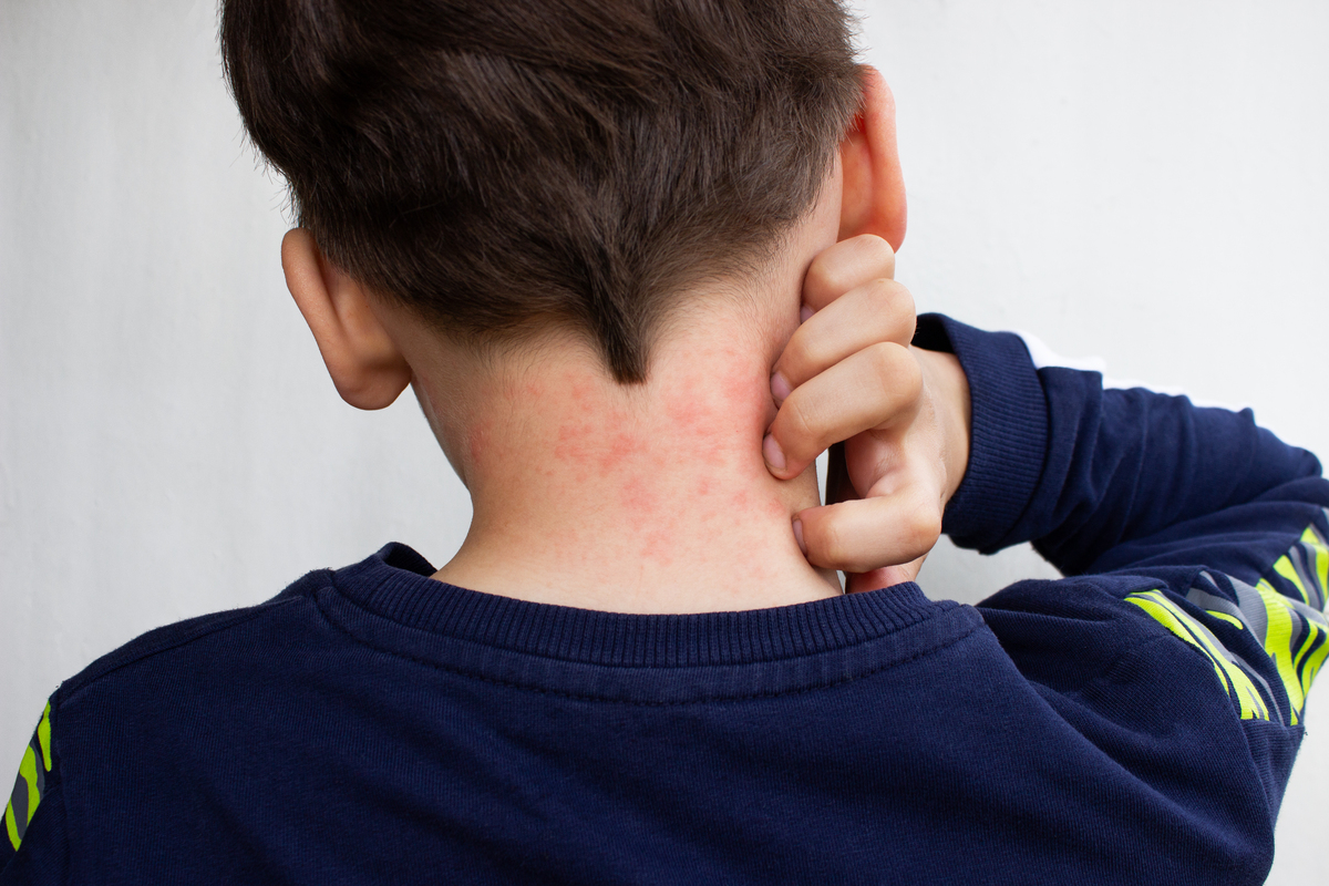 淋巴癌的早期症状有哪些？警惕这些信号！