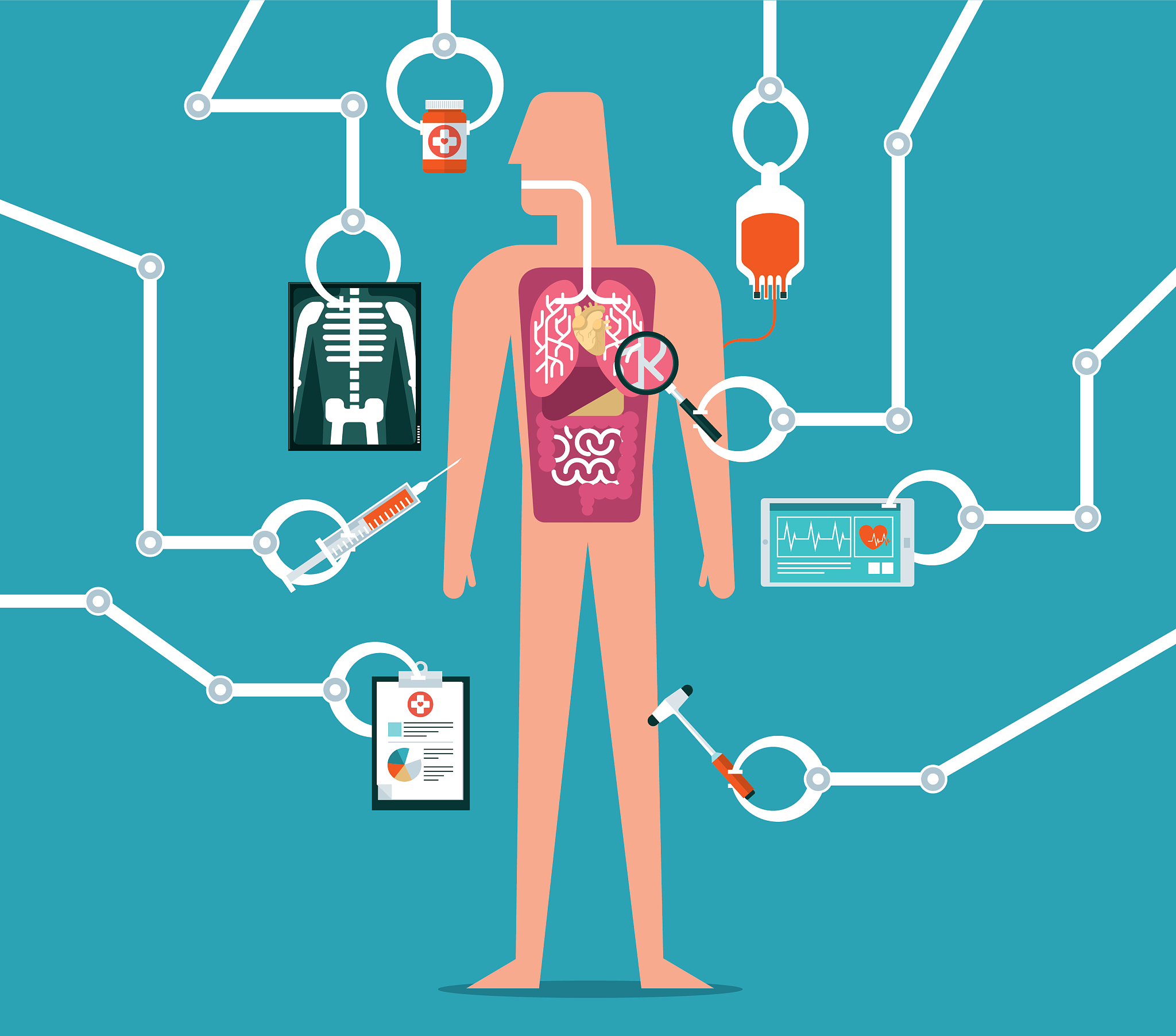66岁男性冠心病患者利尿剂抵抗原因分析
