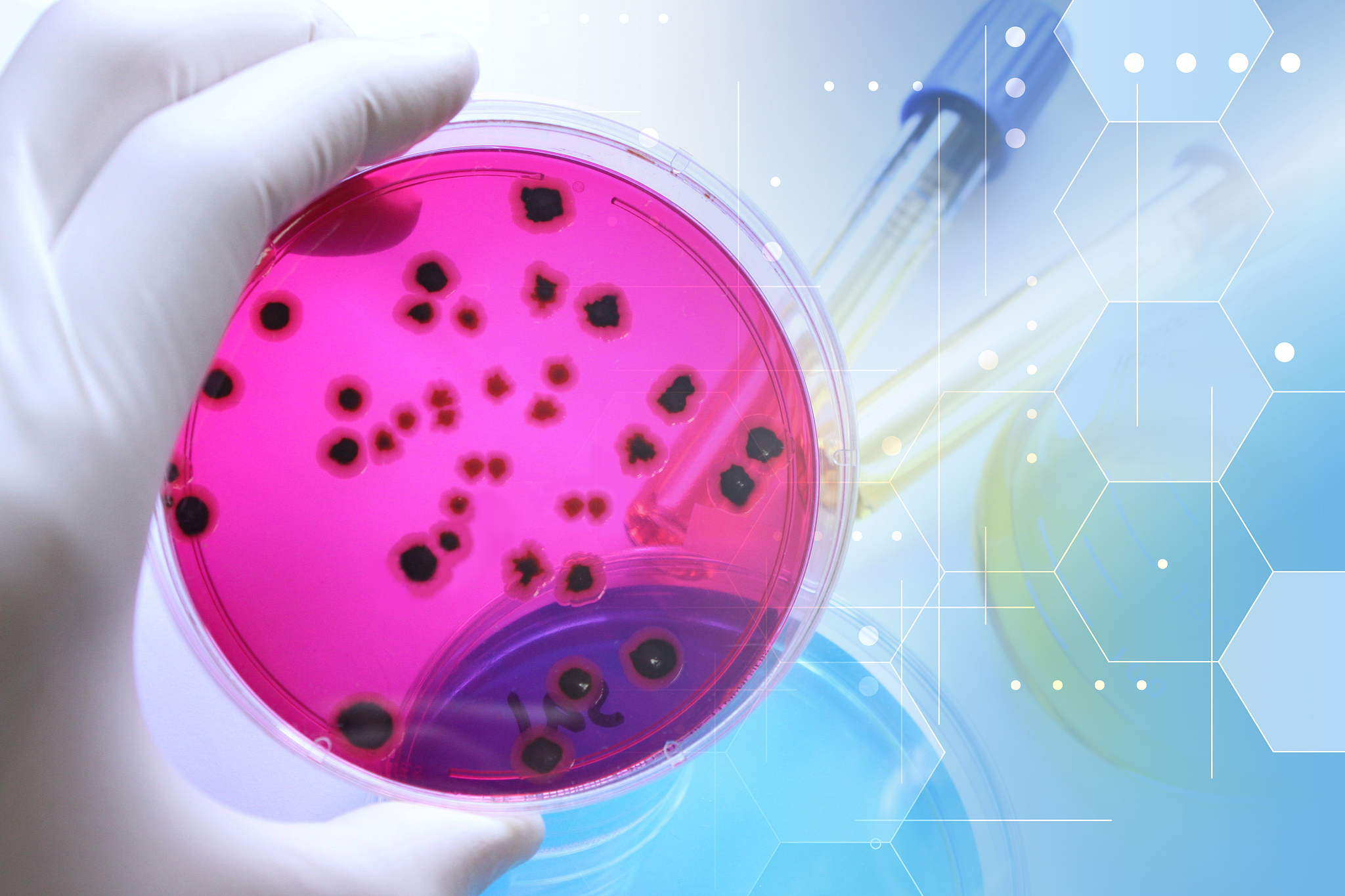 以小明好朋友的视角写一篇2000字记叙文以小明和我病情为线索：小明和我一起吃路边摊都感染病毒在学校拉肚子五天的惨痛经历。详细写学校上课时憋不住请假上厕所一拉就是10几分钟一天泻七八次。中午我也开始拉肚子第二天小明和我一起请假看医生第三天病情好转小明又开始乱吃东西生鸡蛋冰牛奶我还在严重拉肚子一天拉了10几次第四天我已经康复小明并不知道自己已经感染沙门氏菌去学校病情恶化小明一天拉肚子达20多次厕所逐渐