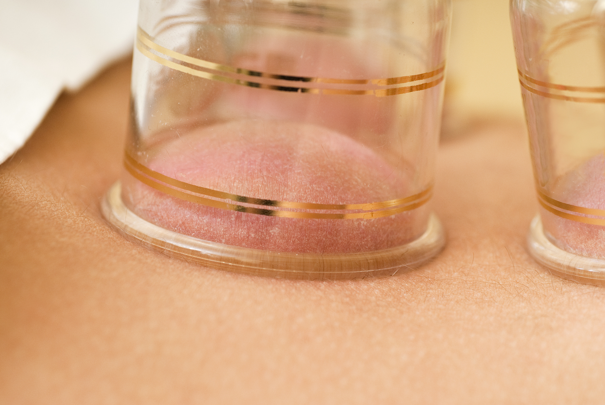 2019年重庆职校中医骨伤专业介绍