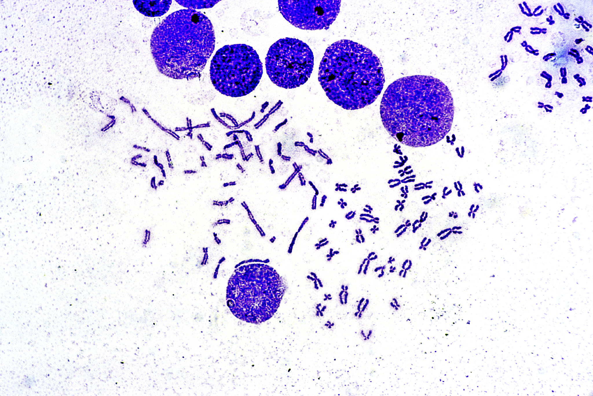 如何分辨染色体和染色单体🧬