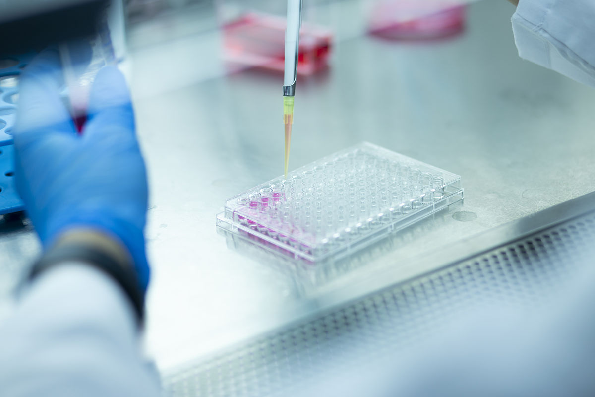 生物医学事件抽取步骤 生物医学事件抽取步骤