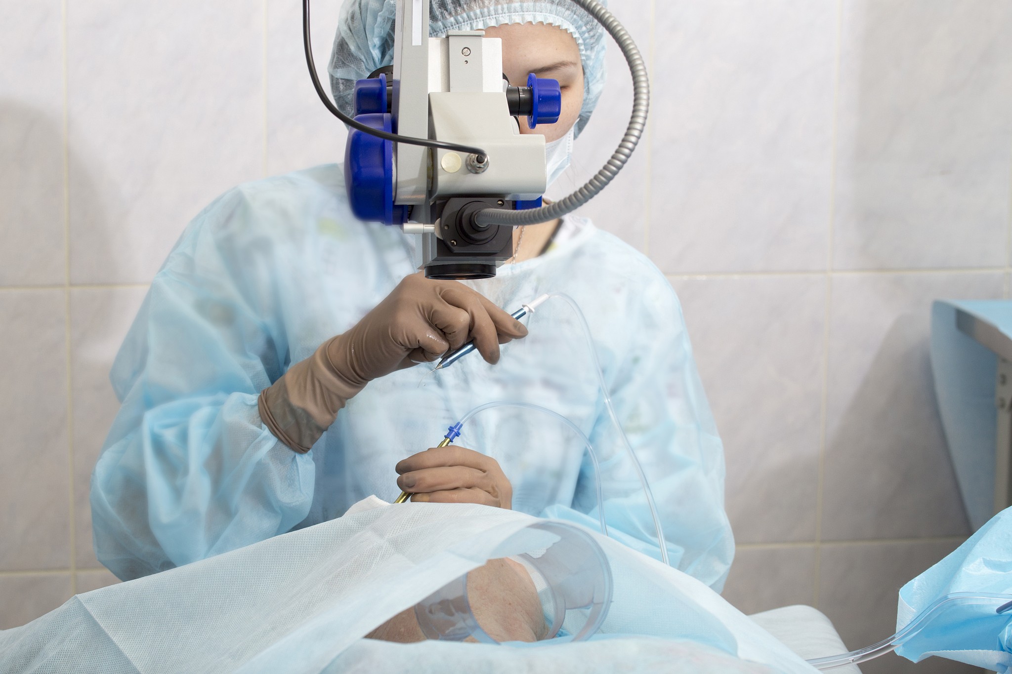 速高捷在近视激光手术的应用