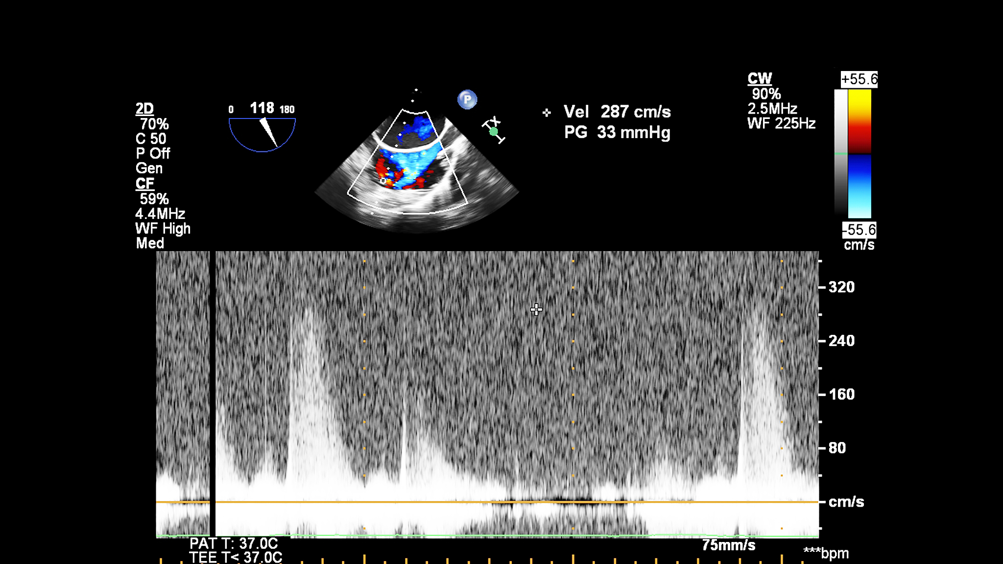 激波抖振数值模拟研究的历史发展