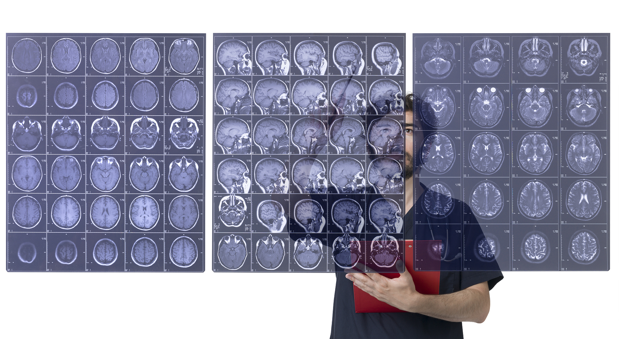 新冠肺炎CT图像深度学习分类项目：快速诊断与疫情防控