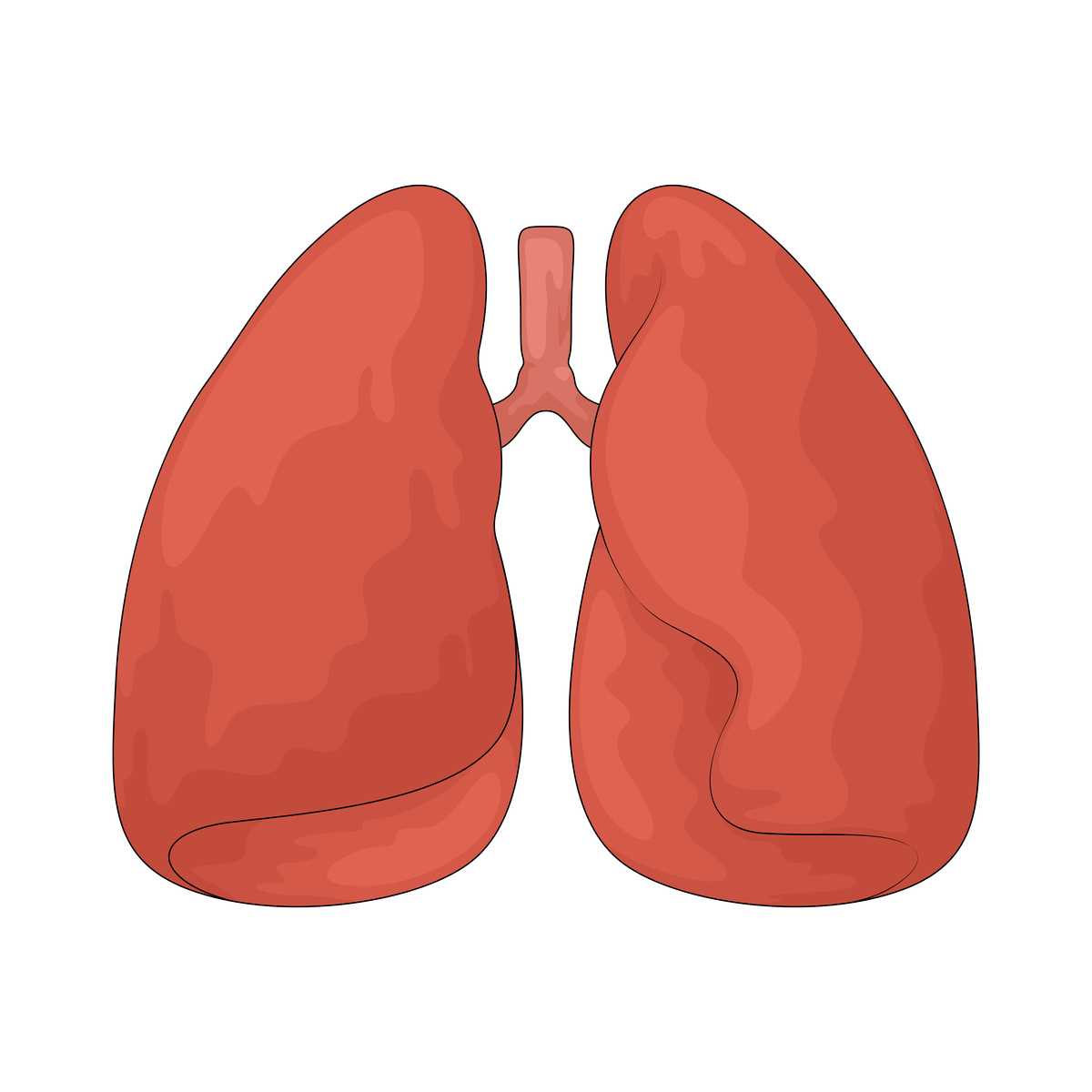 大叶性肺炎：一种常见的呼吸道感染