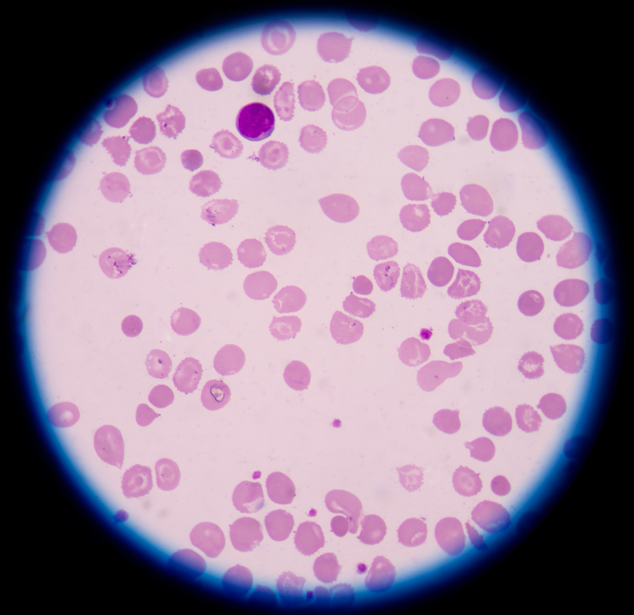 小孔计数法区分红细胞和血小板原理