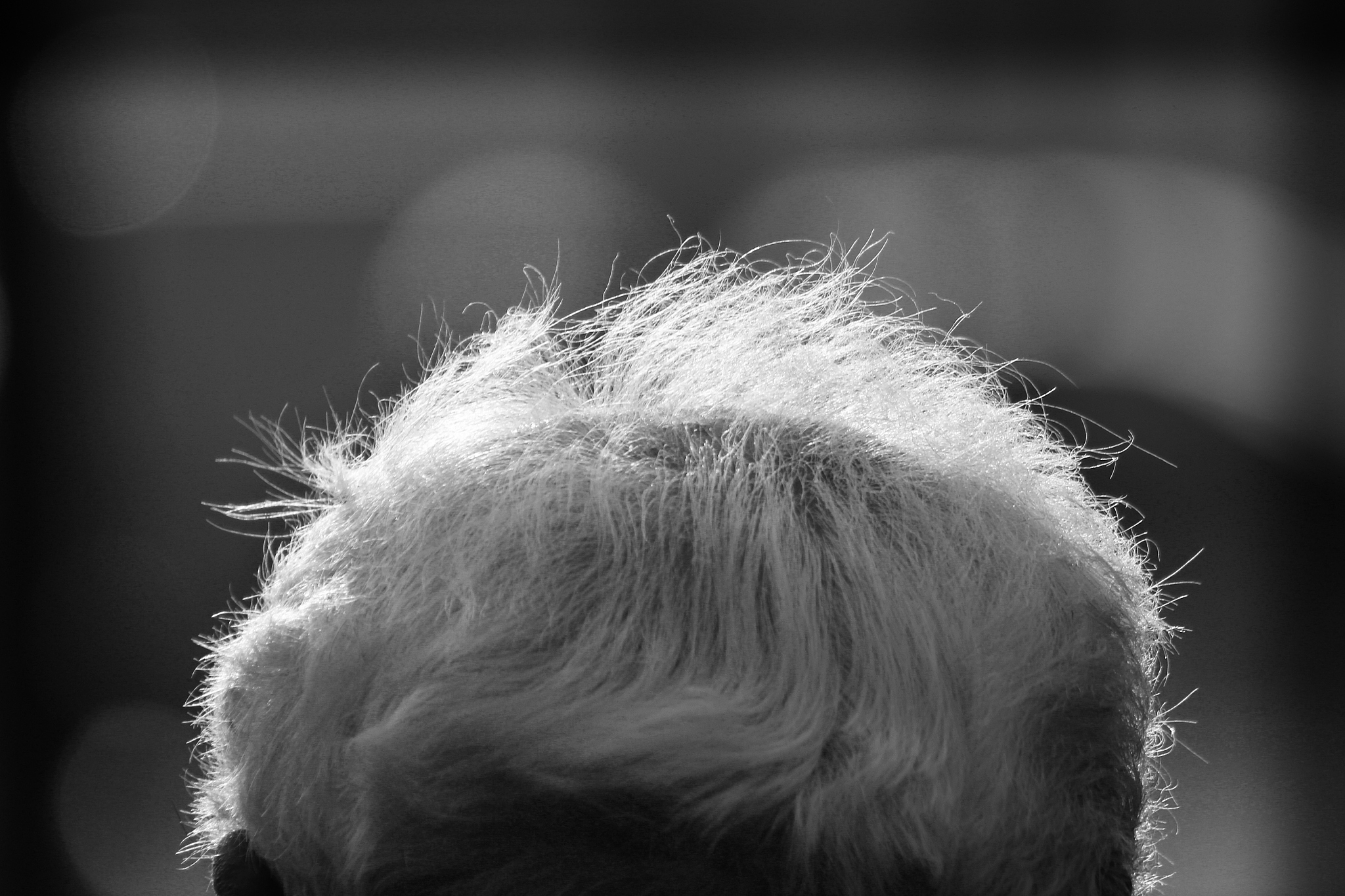 少年白发如何变黑