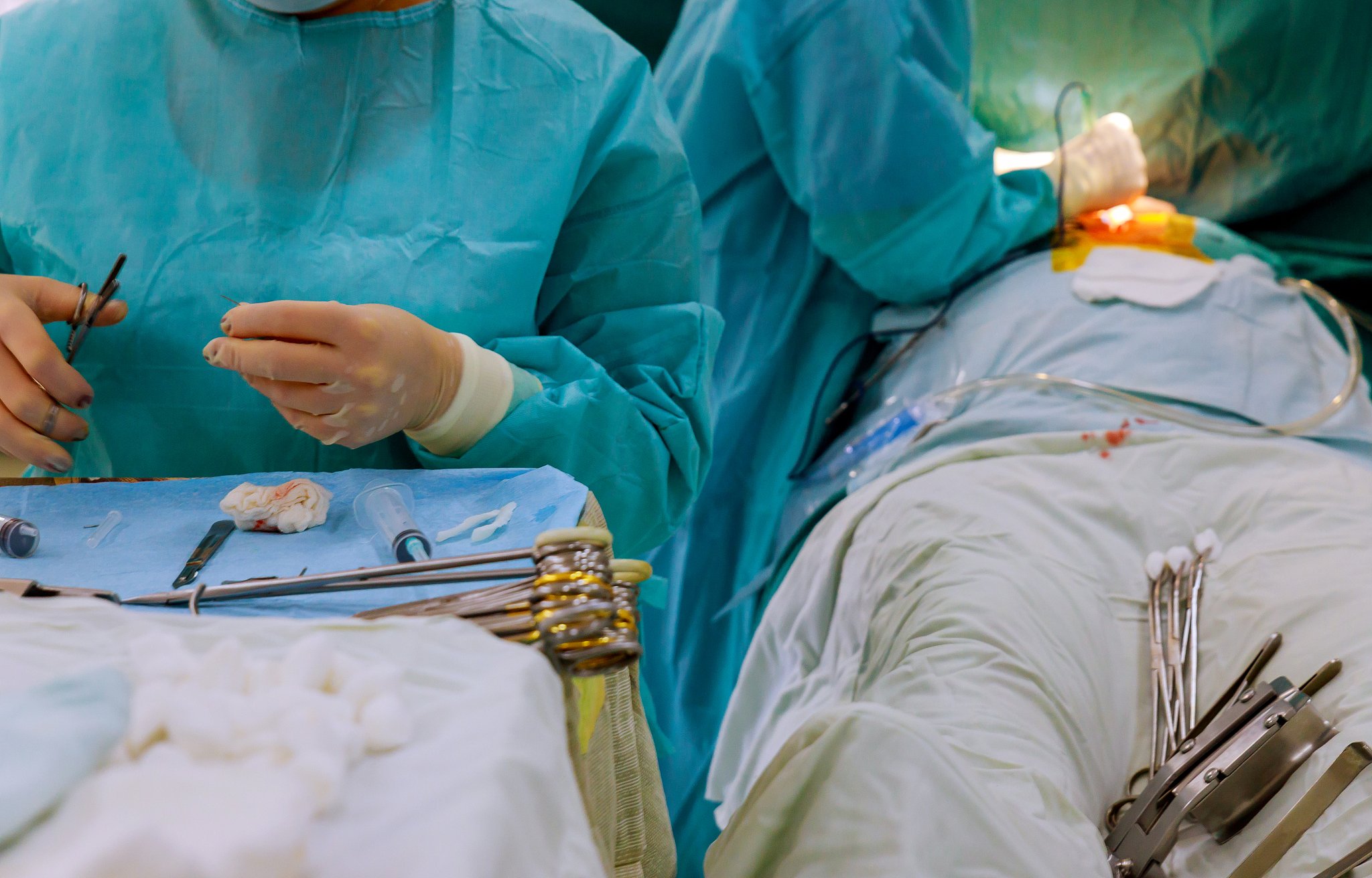 midsection of surgeon performing surgery