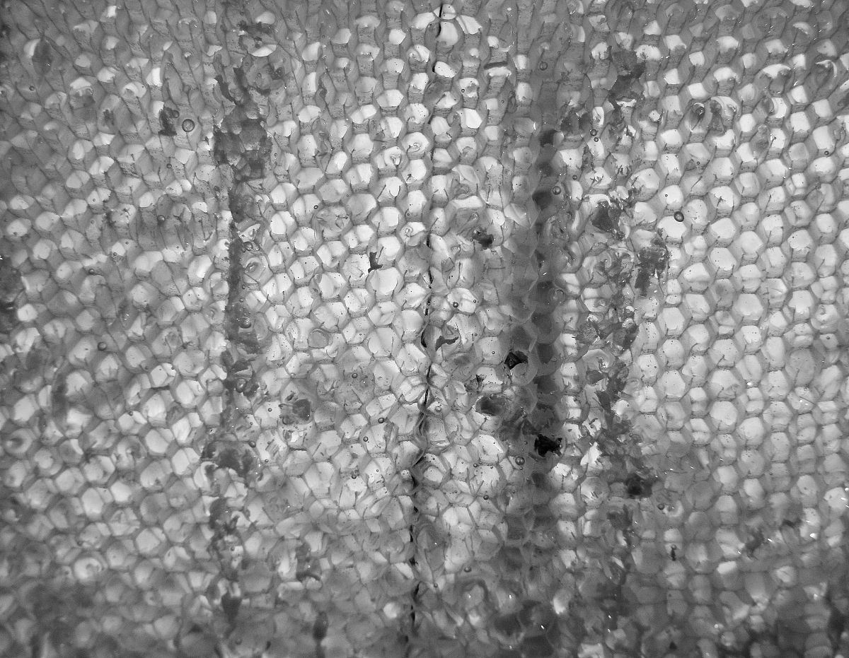 黑色素细胞排列特点