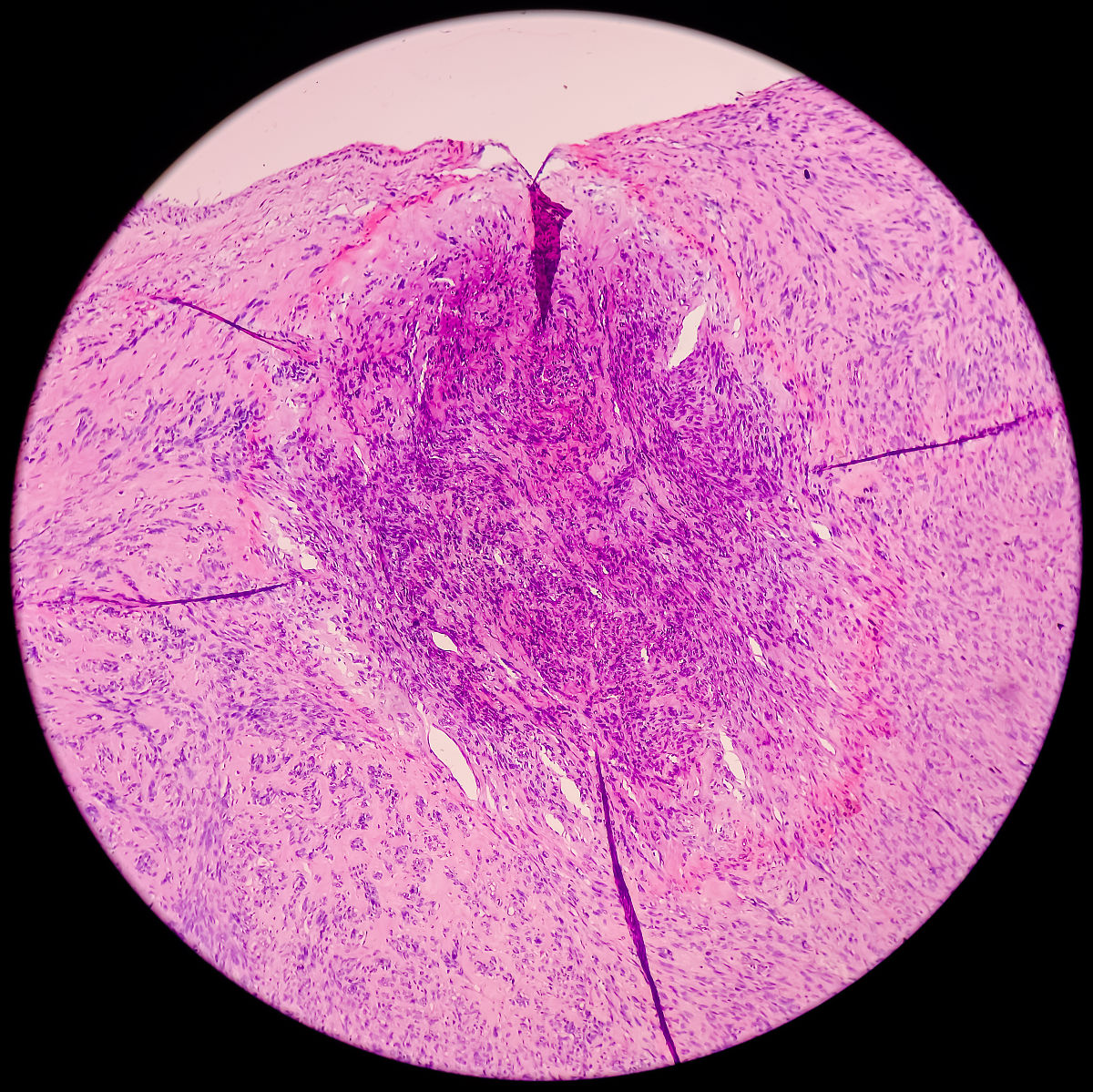 月经量过多怎么办？如何调理？