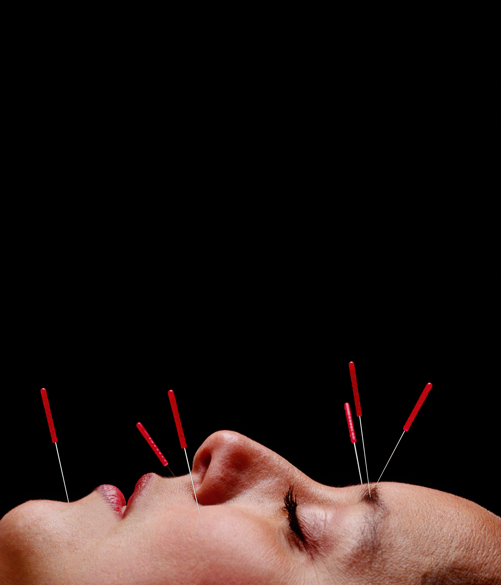 人的脸部,<strong>针灸</strong>,特写,女人,仅中年女人,仅一个中年女人,替代医药,35岁