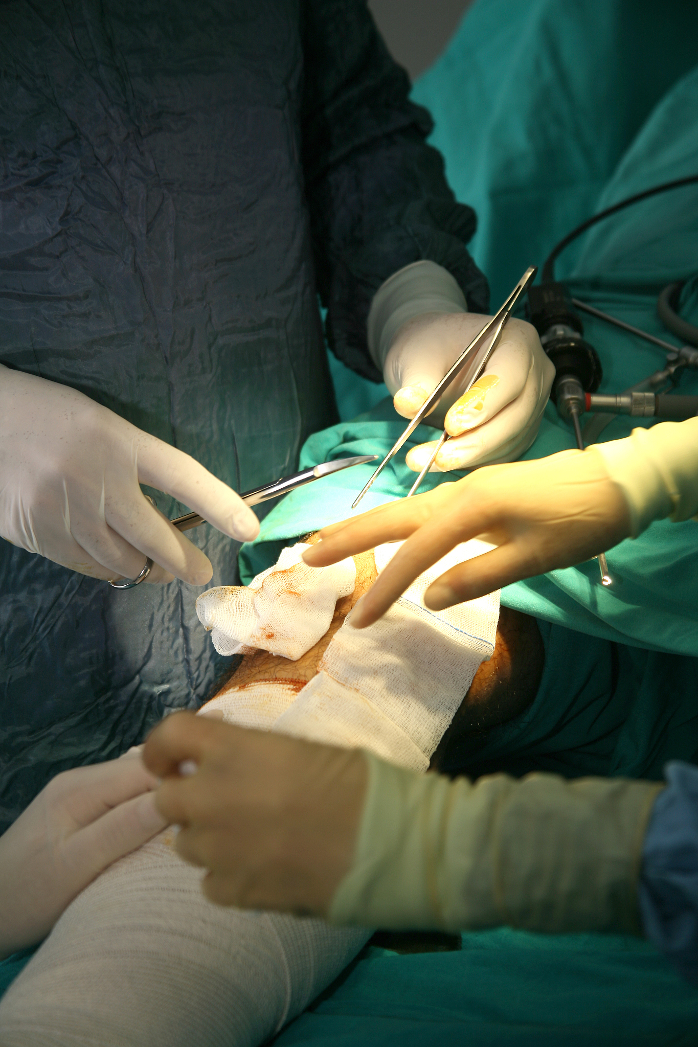 doctors are on an operation