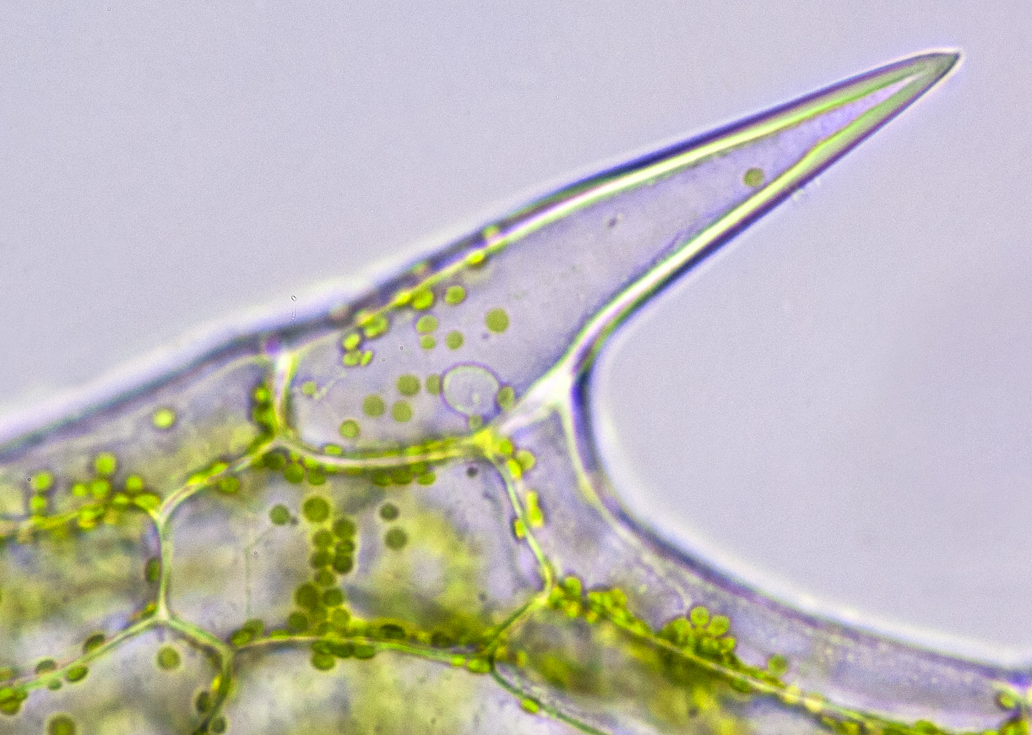 黑藻叶片叶绿体：类型、形状、颜色、位置及功能