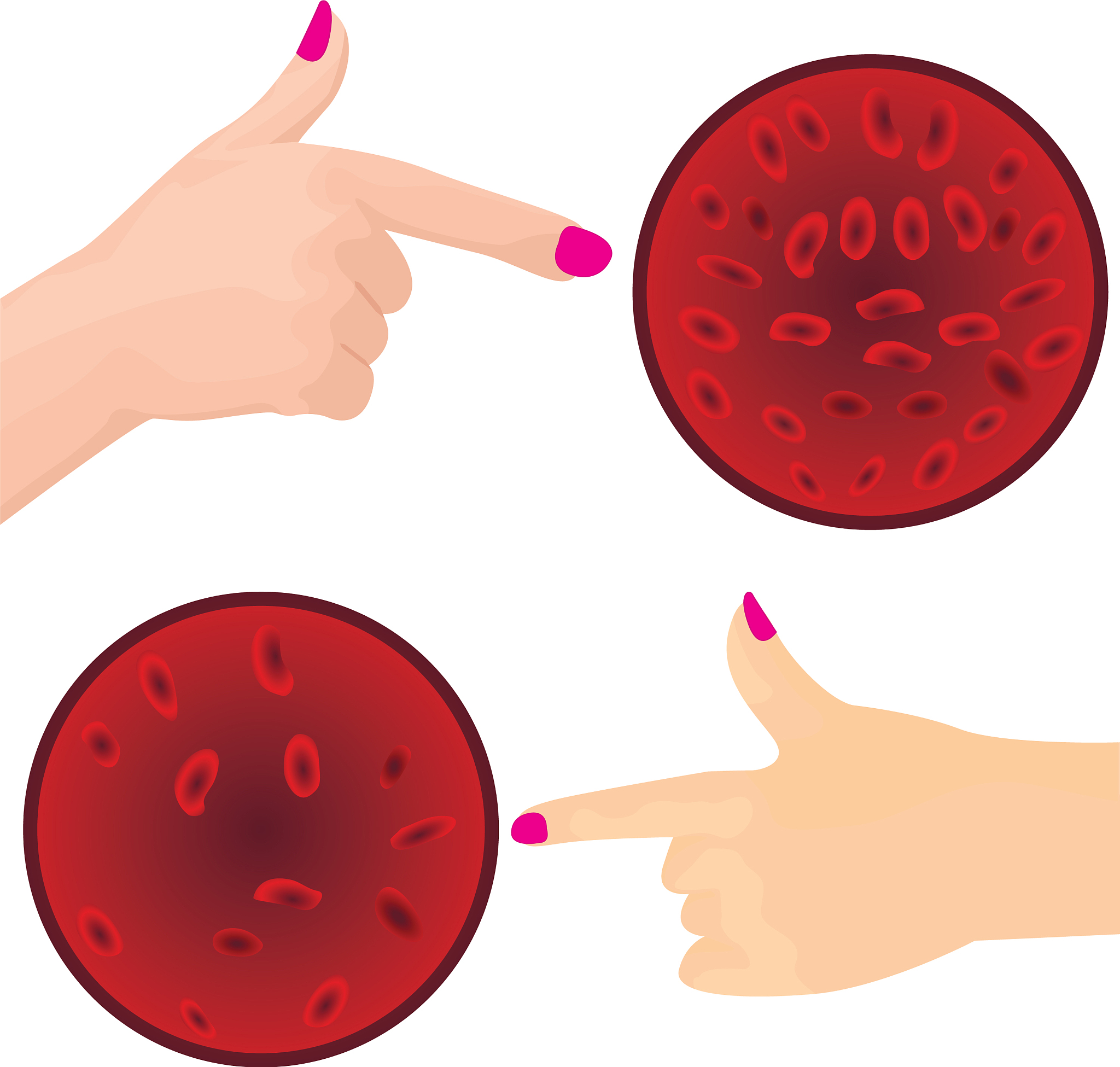 Excess Iron: Risks, Removal, and Transferrin's Role