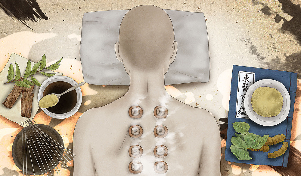 herbal medicine and cupping treatment