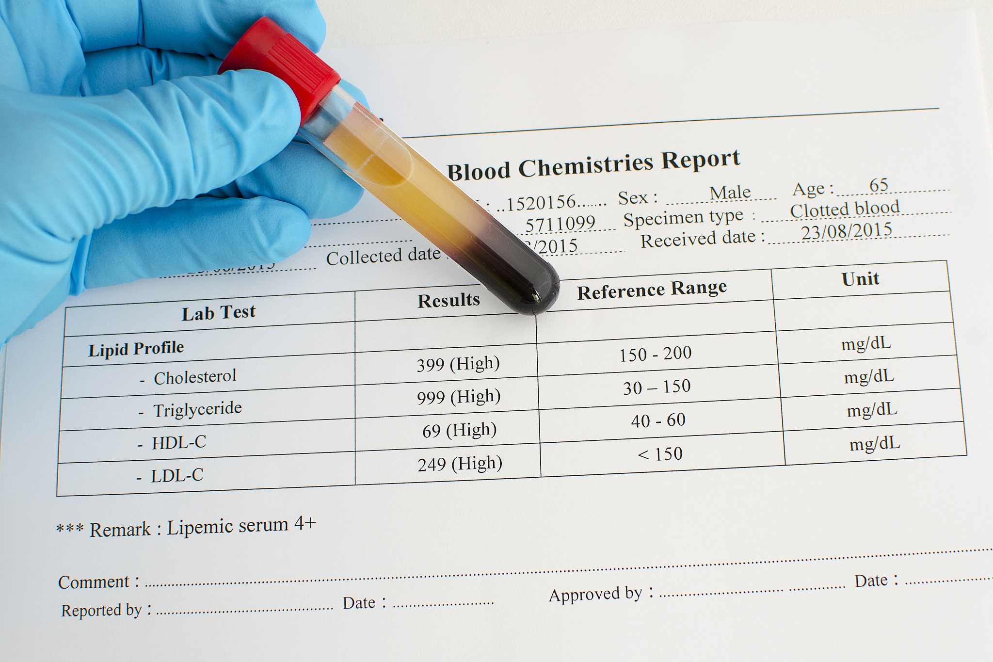 脂蛋白(a) 281.5nmol/L 高？如何应对？
