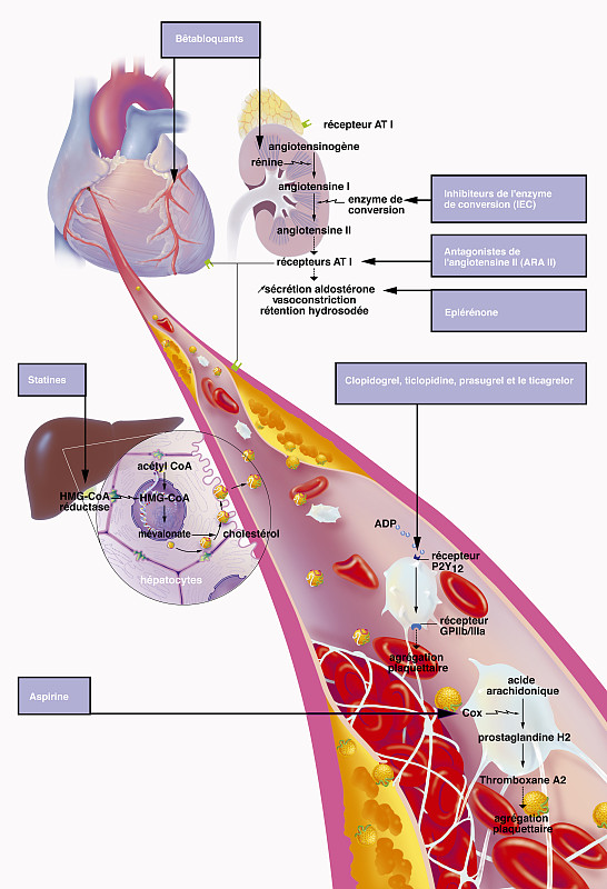 以急性心肌梗死患者PPCI流程管理及患者的术后管理写一个项目可行性报告需包含1、立项的背景和意义2、国内外现状和发展趋势3、研究内容、研究目标、拟解决的问题和今后研究思路4、研究方法、技术路线和进度安排5、主要创新点6、项目预期成果、考核指标7、现有工作基础和条件8、经费预算与说明需在项目背景和意义中列出参考文献技术路线需提供表格及流程图。此项目可行性报告的总字数不少于2万字
