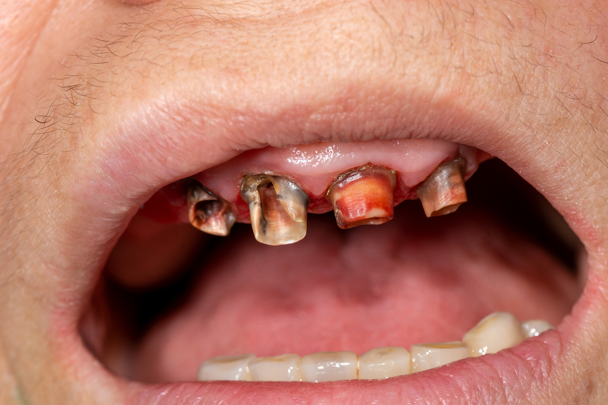 菏泽家政职业学院口腔医学技术专业怎么样？就业前景如何？