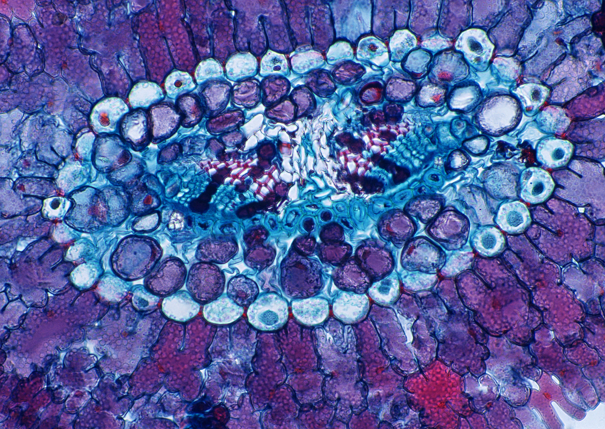 Lung Cancer: A Comprehensive Overview of Epidemiology, Diagnosis, Treatment, and Research