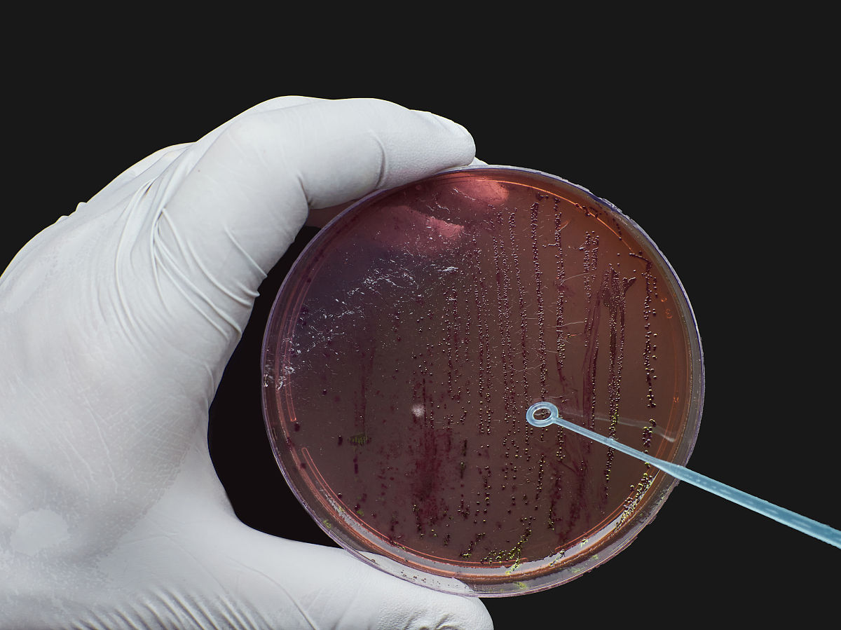 你是一名生物学学者接下来请按我发送给你的格式写实验报告实验报告实验名称：观察植物细胞的结构实验目的：了解植物细胞的结构及其功能。实验原理：植物细胞是由细胞壁、细胞膜、质膜、质网、线粒体、叶绿体、高尔基体、核糖体、核仁和细胞核等组成的。本实验将使用光学显微镜观察植物细胞的结构。实验步骤：1 取一片新鲜的植物叶片用刀片切成薄片。2 将切好的植物叶片放入显微镜载玻片上。3 在载玻片上滴上一滴甘油使植物细