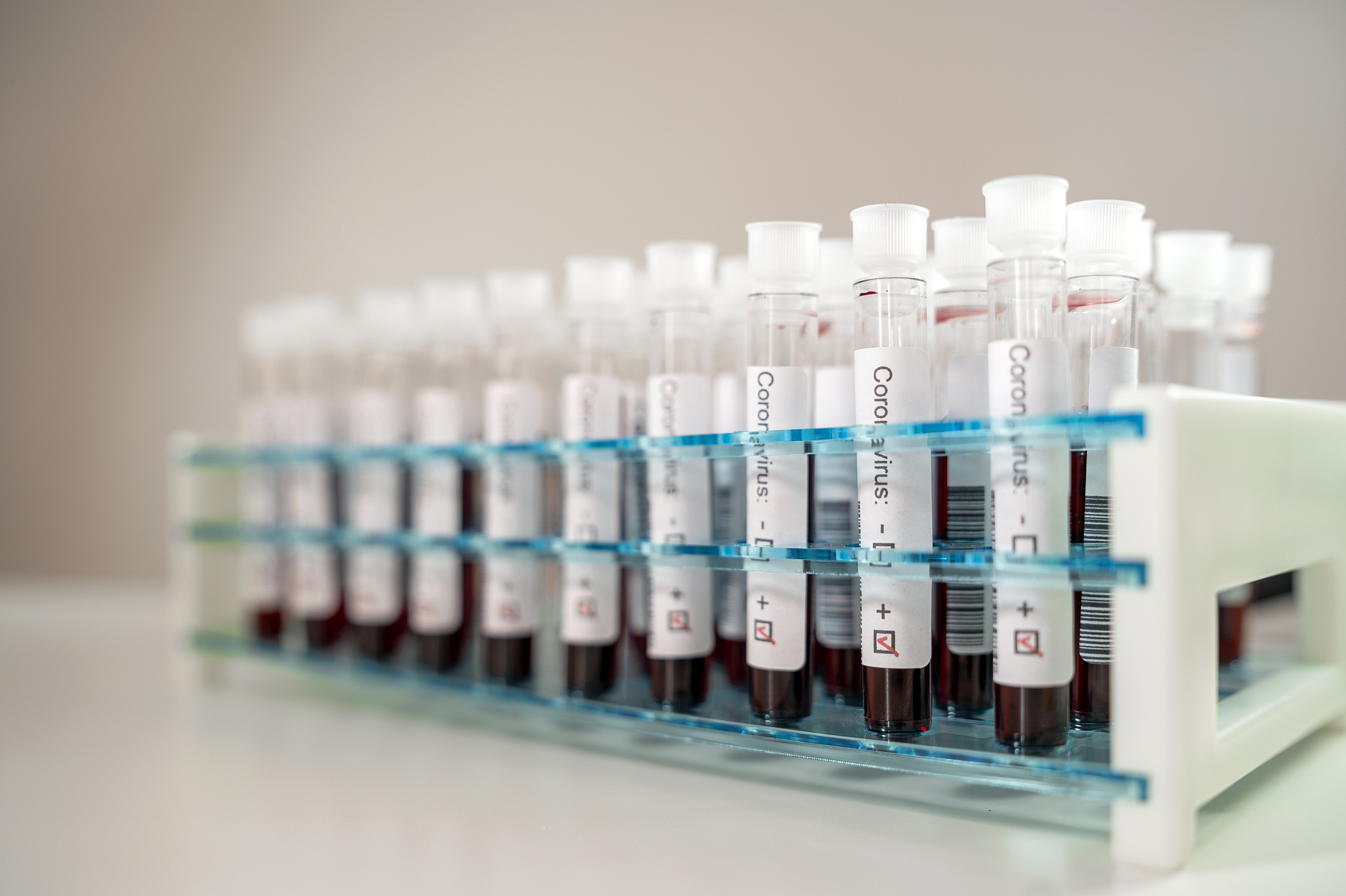 怎么将然而实验结果容易受批次、环境等多种因素影响对结果的准确性和稳定性有较大影响中的第二个影响换个词