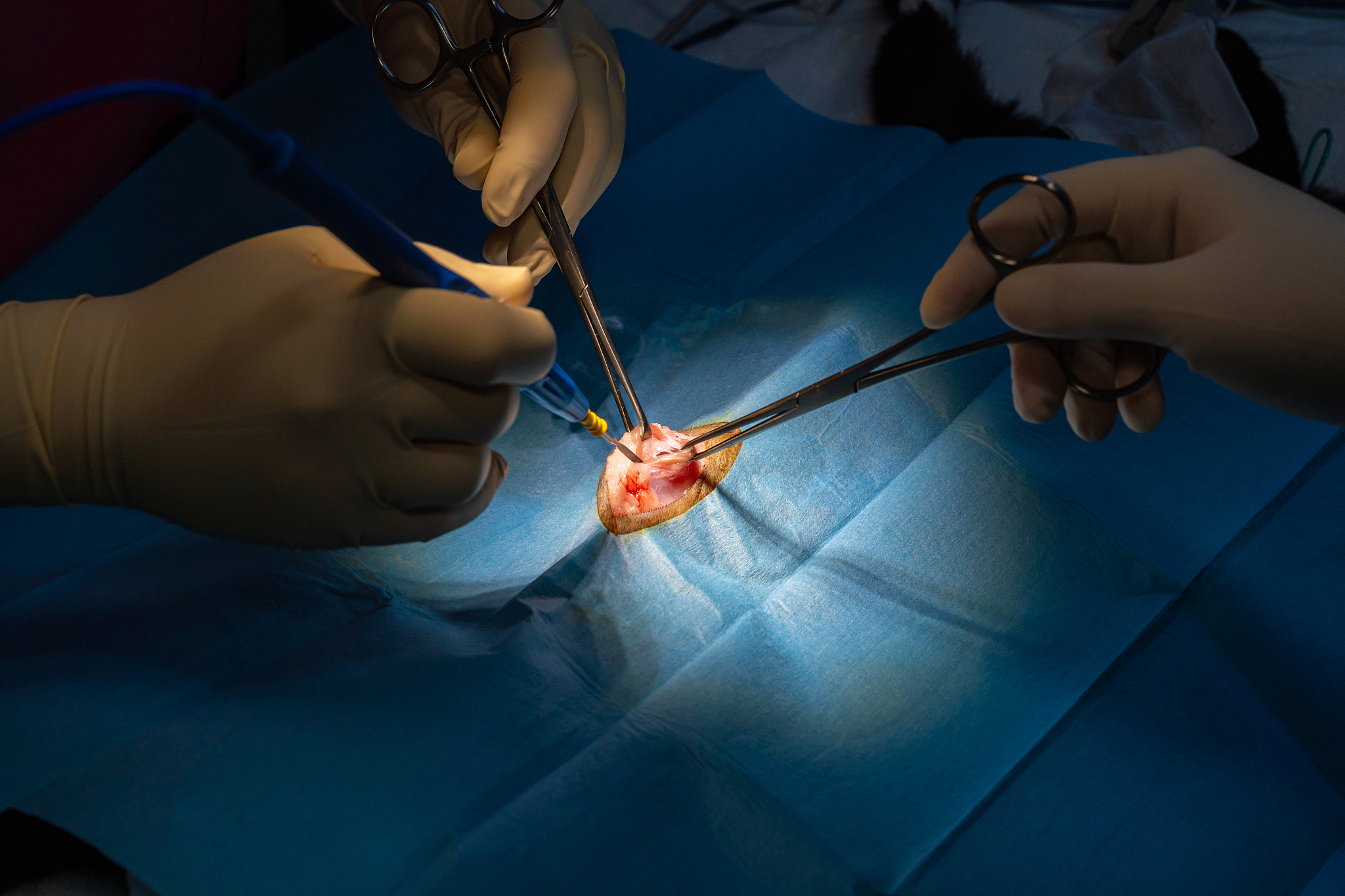 surgical incision with dissection forceps and electric scalpel o