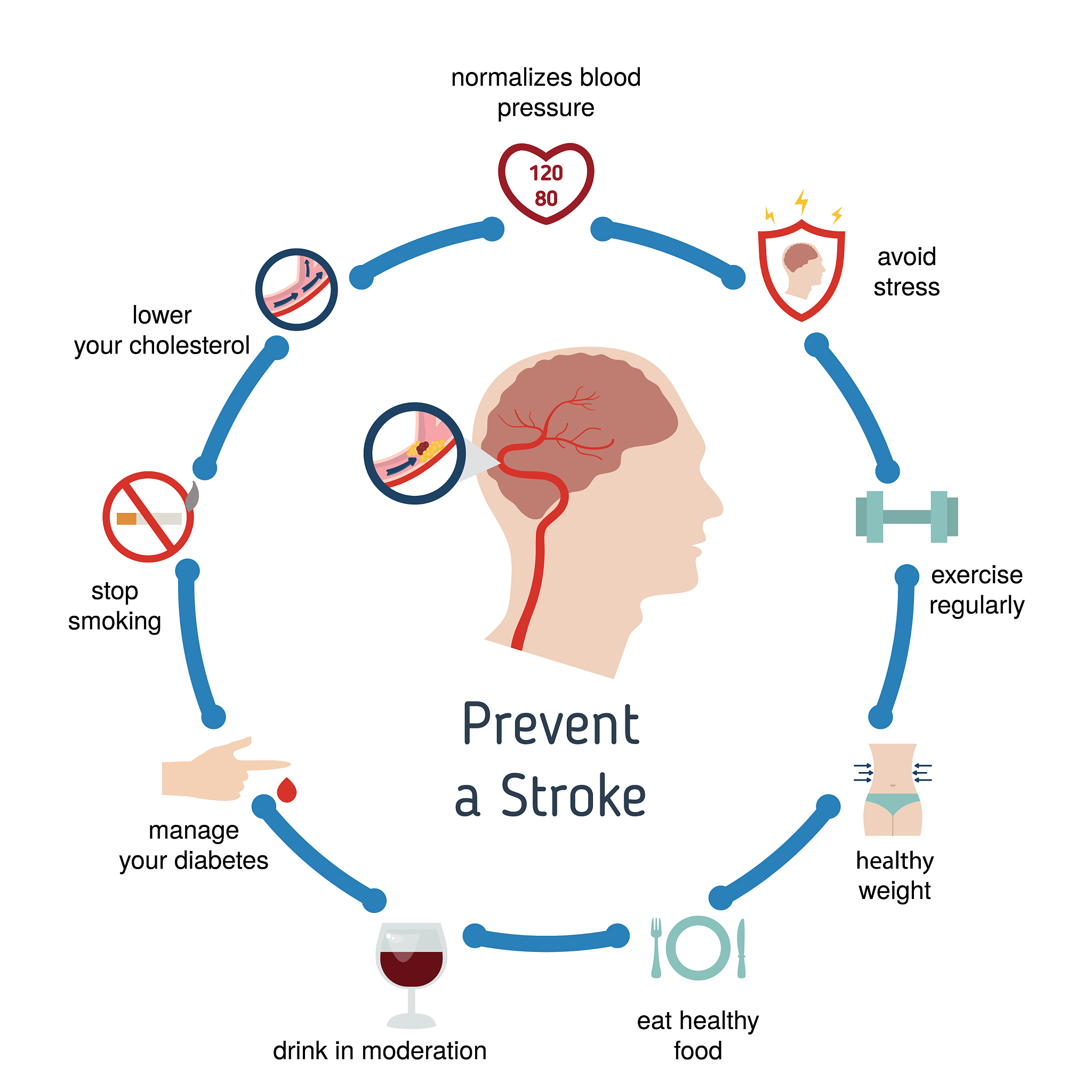 Brain Damage and Movement Disorders: Understanding the Impact of Stroke