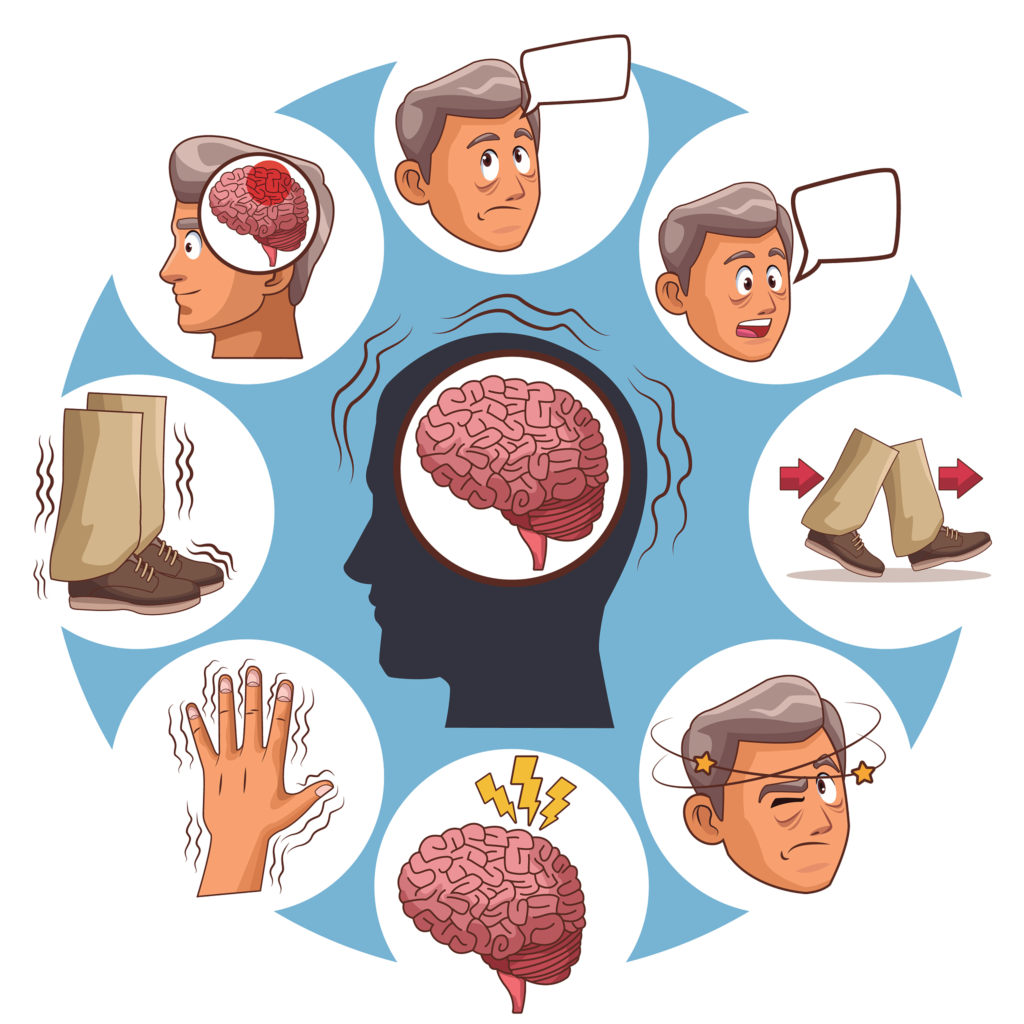 脑卒中：症状、类型、预防和治疗 - 详细指南