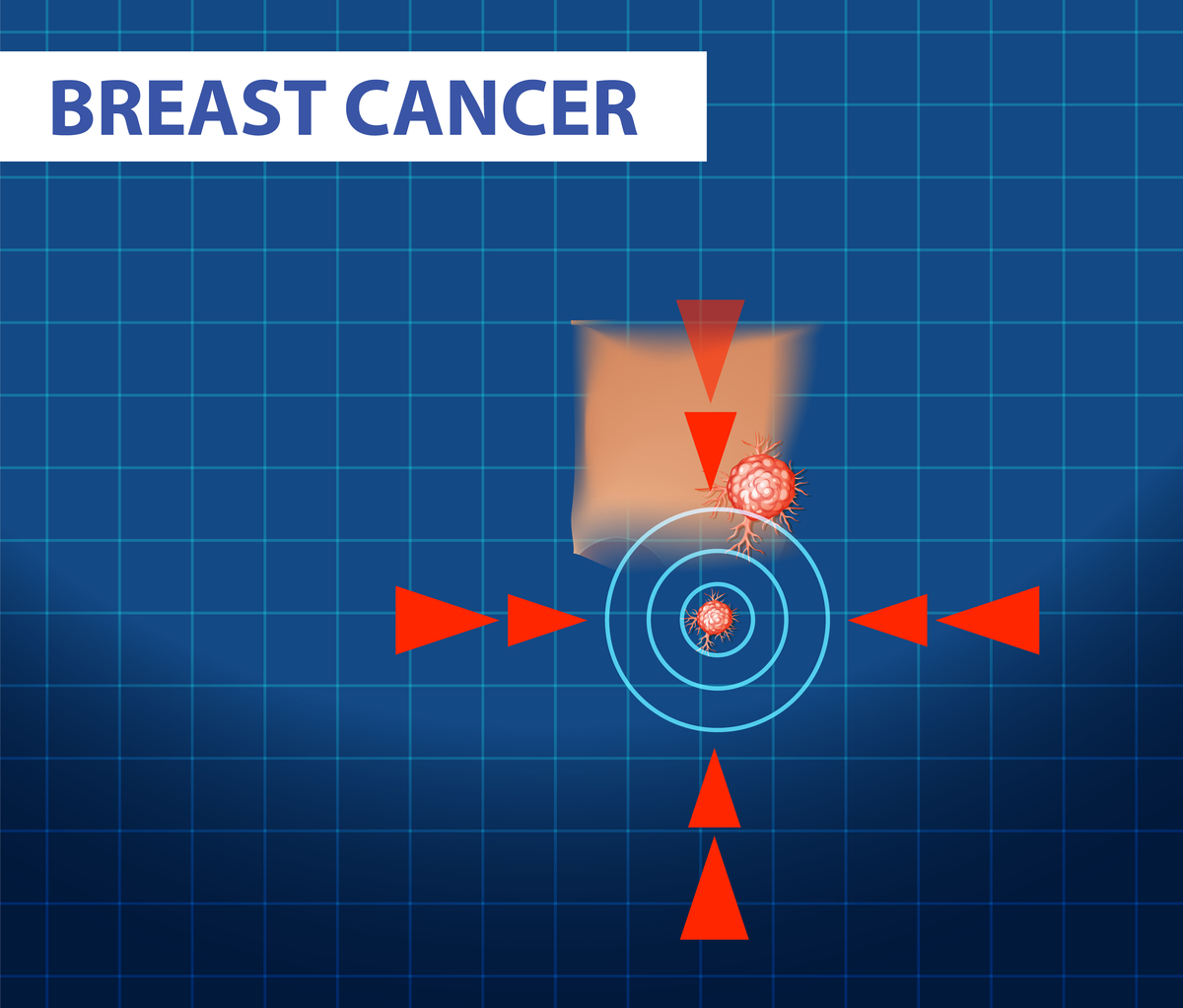 电子直线加速器为什么要抽真空？