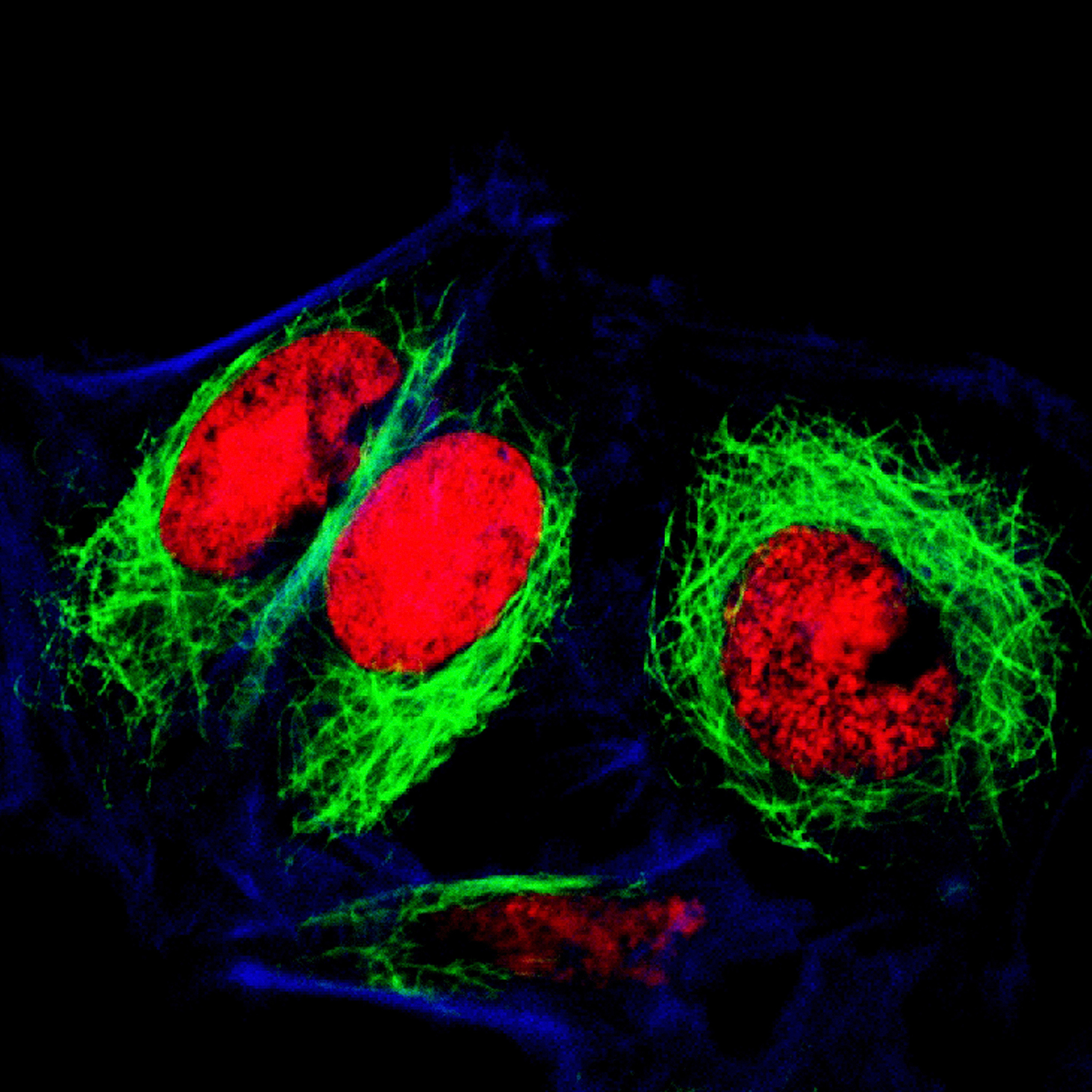 详细说说：尼罗红也被称为尼罗蓝恶嗪酮是一种亲脂性染料尼罗红NR分子具有大的芳香环和基态时可与水分子形成氢键的吸电子基它对环境非常敏感。尼罗红在脂质丰富的环境中具有强烈的荧光在以水为介质的环境中其荧光强度非常弱