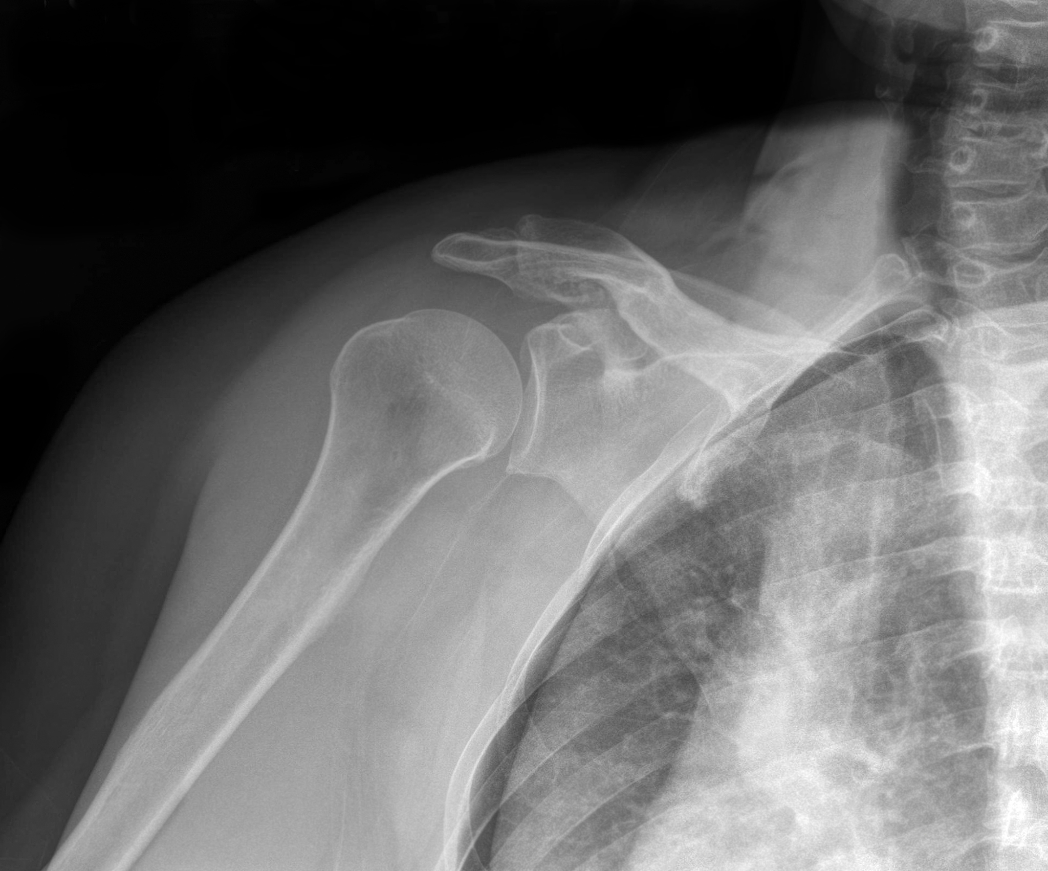 慢性病：类型、病因、预防与治疗全解析
