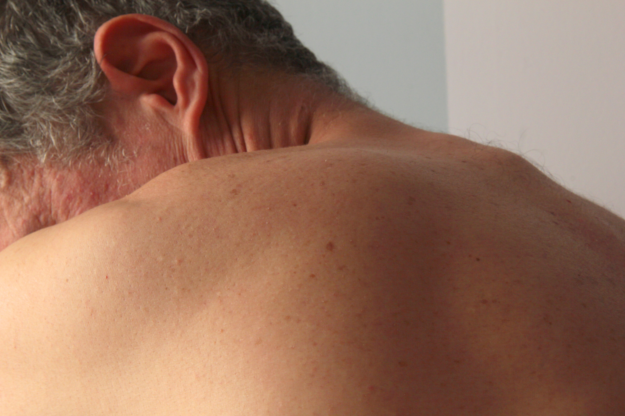 mature man back