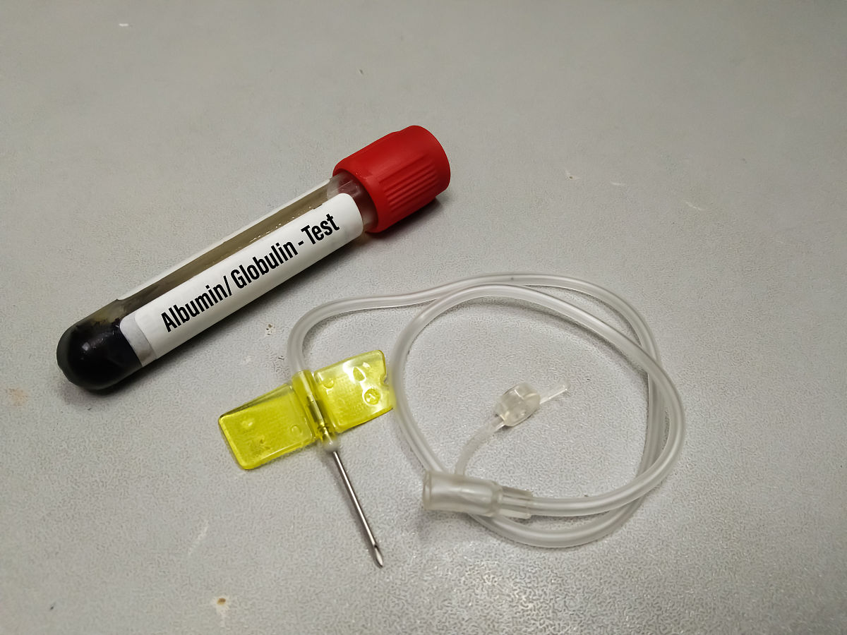 PaO2测量电极是一种气敏电极。正确么