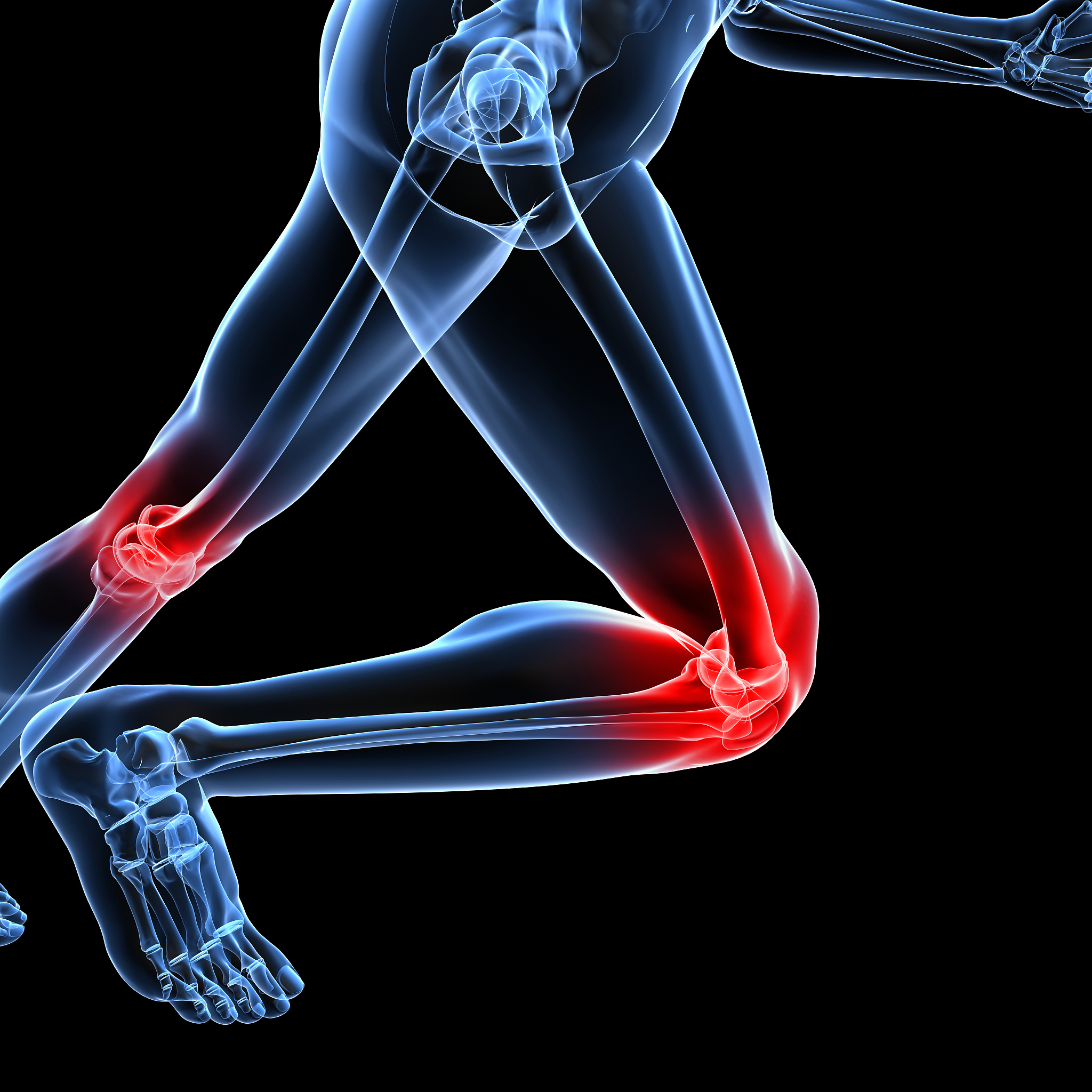 跑步后小腿膝盖疼痛？原因分析及应对措施