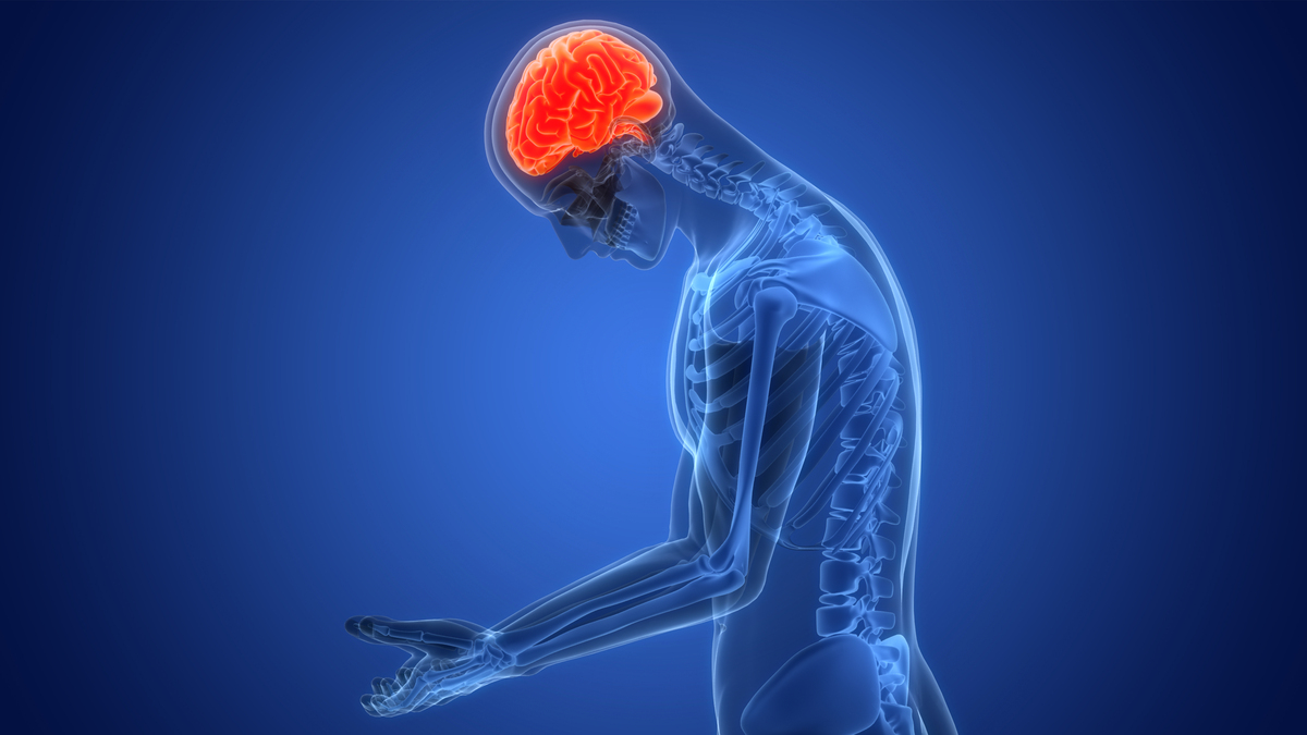 肌肉能量技术治疗脑卒中后肩痛的优势