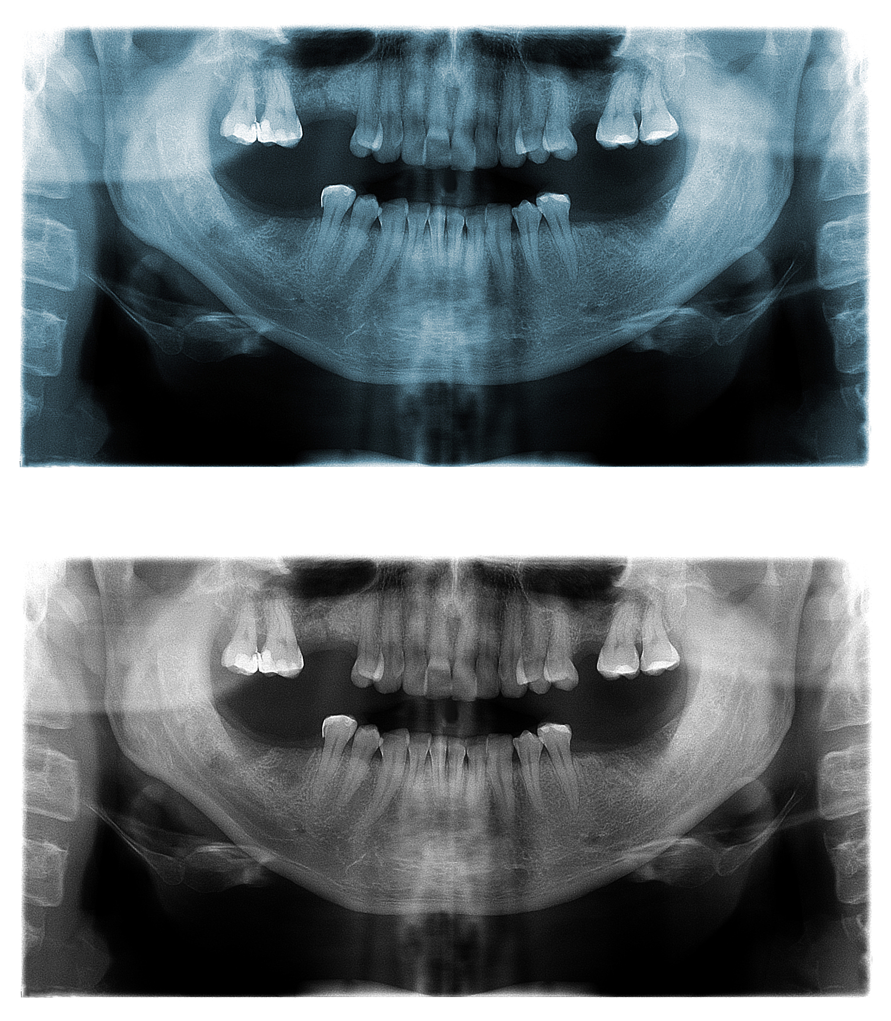 重庆沙坪坝区卫校热门专业推荐：医学影像技术、护理、口腔医学技术