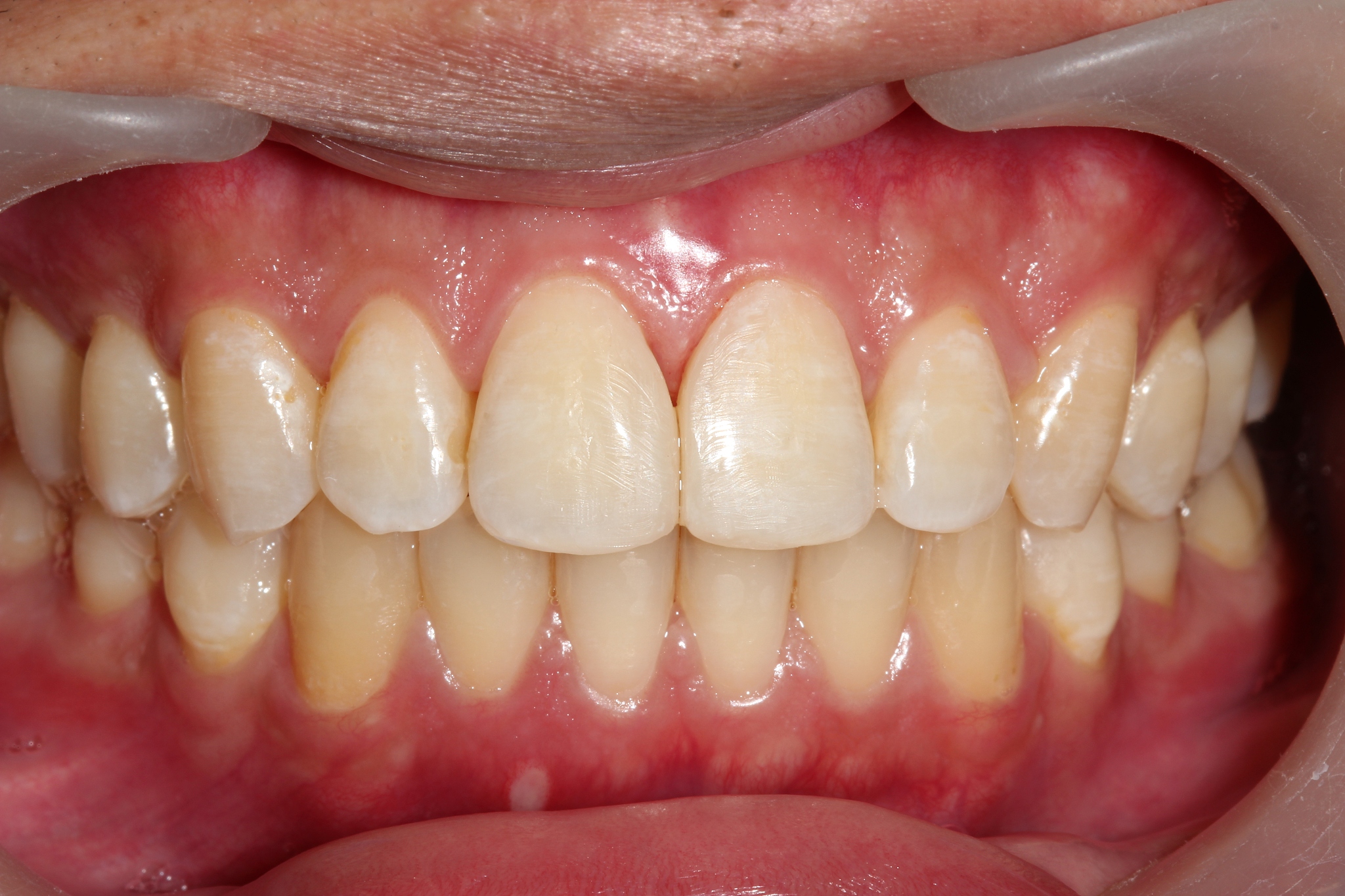 口腔药物设计报告：提高口腔疾病治疗水平