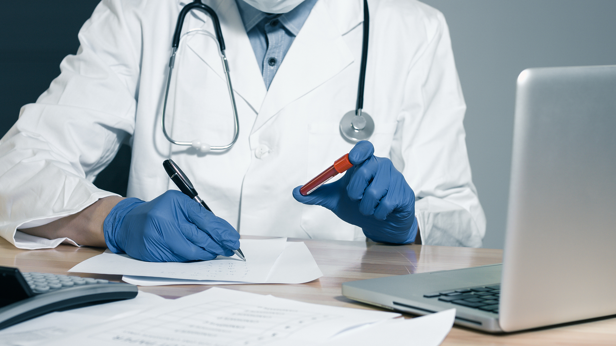 hand of a doctor holding blood sample