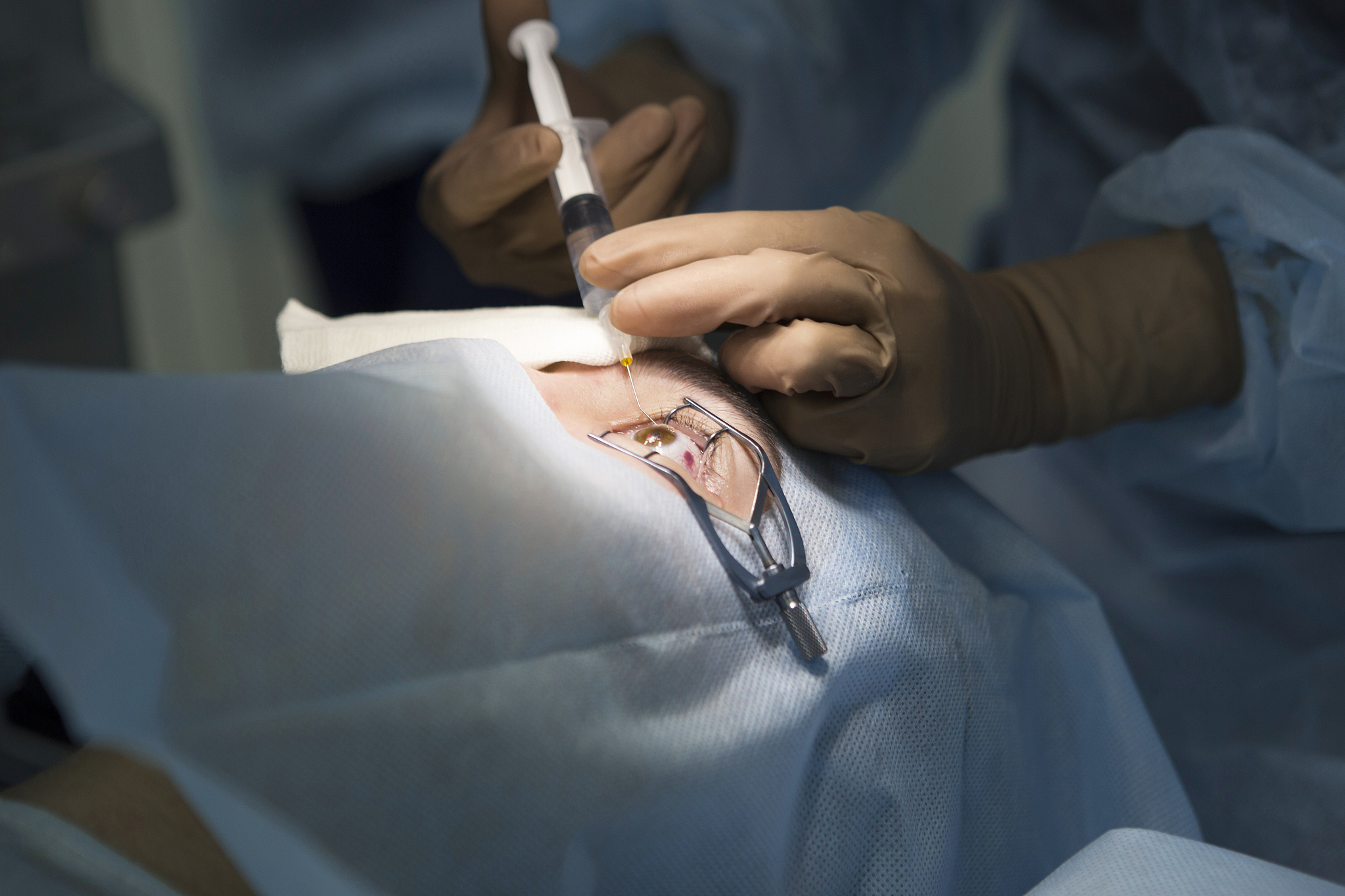 laser surgery for vision correction
