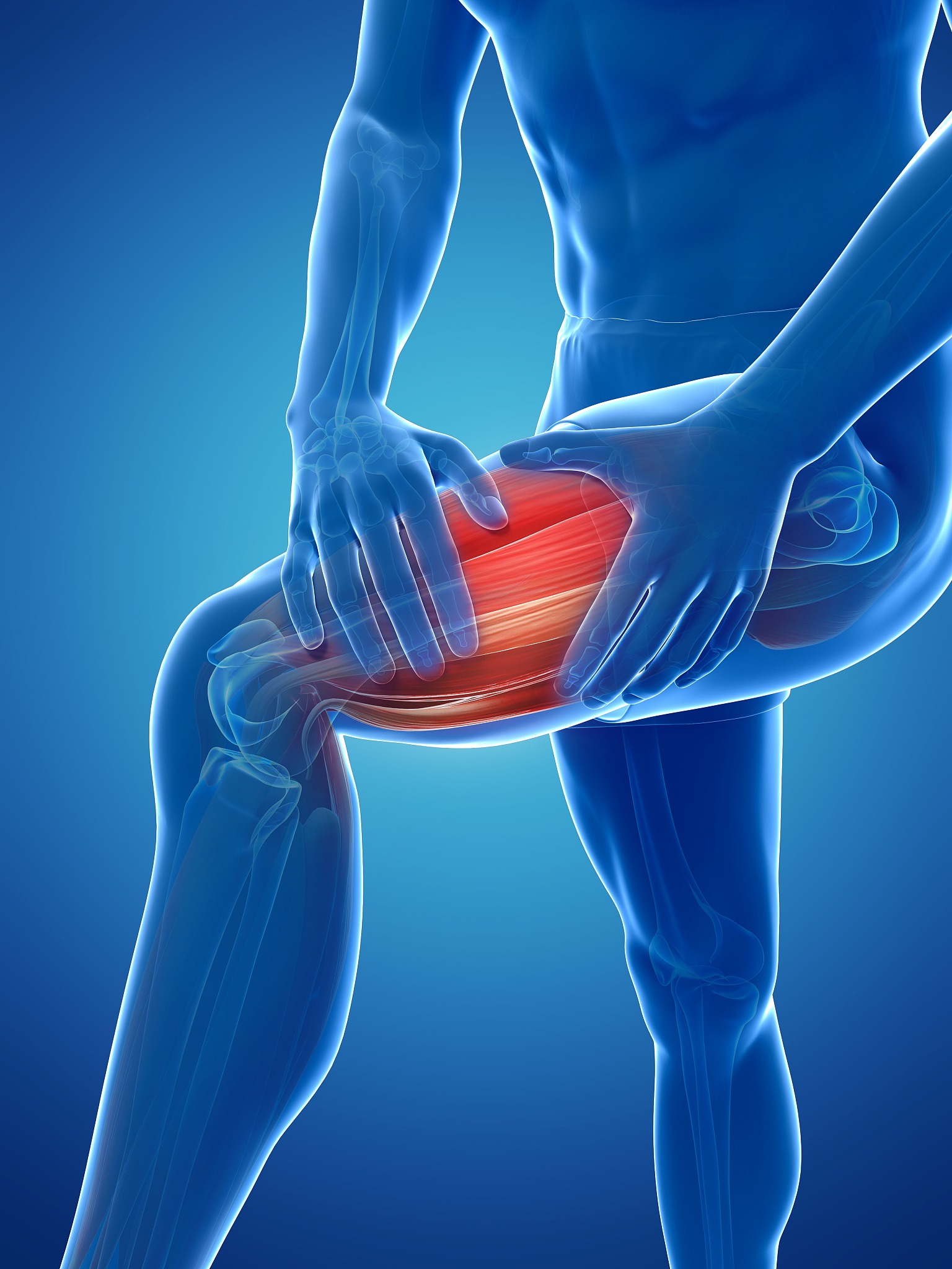 大腿拉伤后第三天抽筋？可能是这几个原因！