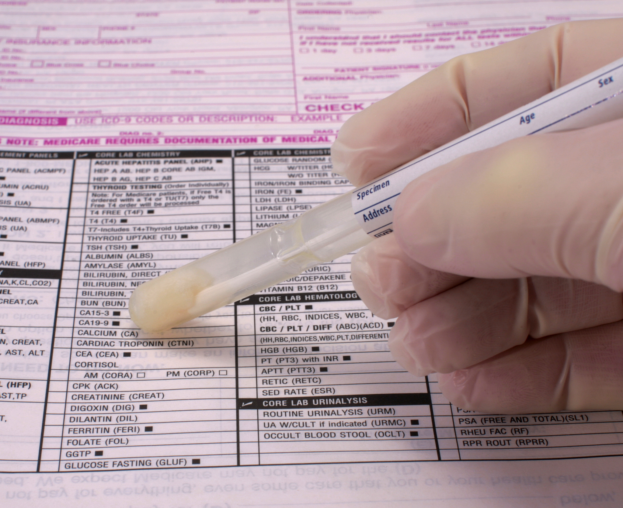 胰岛素类似物活性体外及体内实验方案