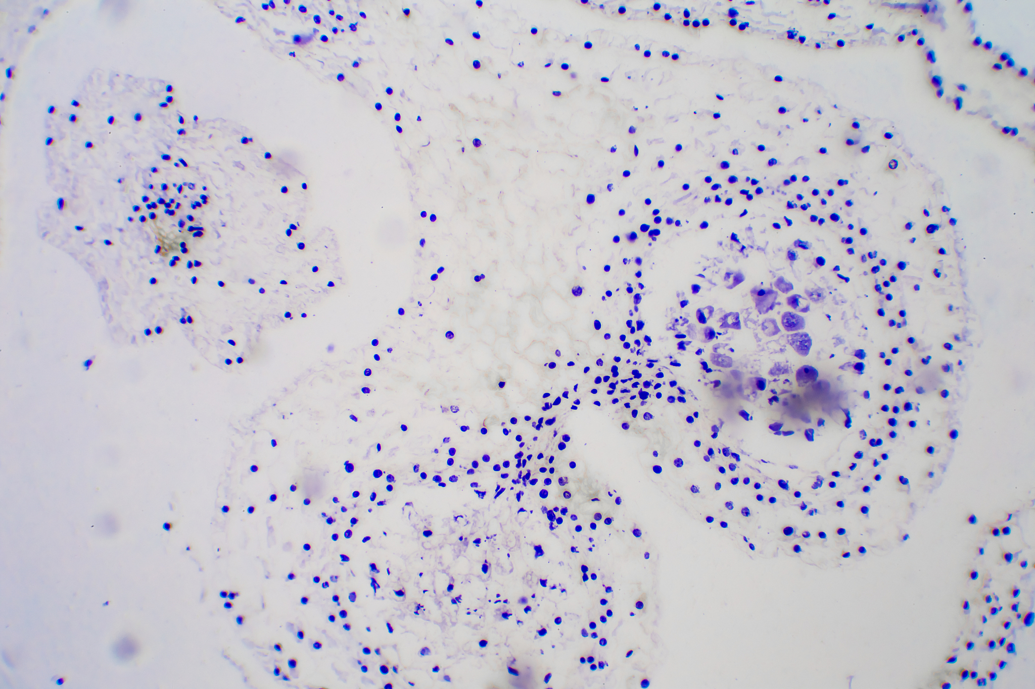 阿利新蓝染色图片如何定量分析