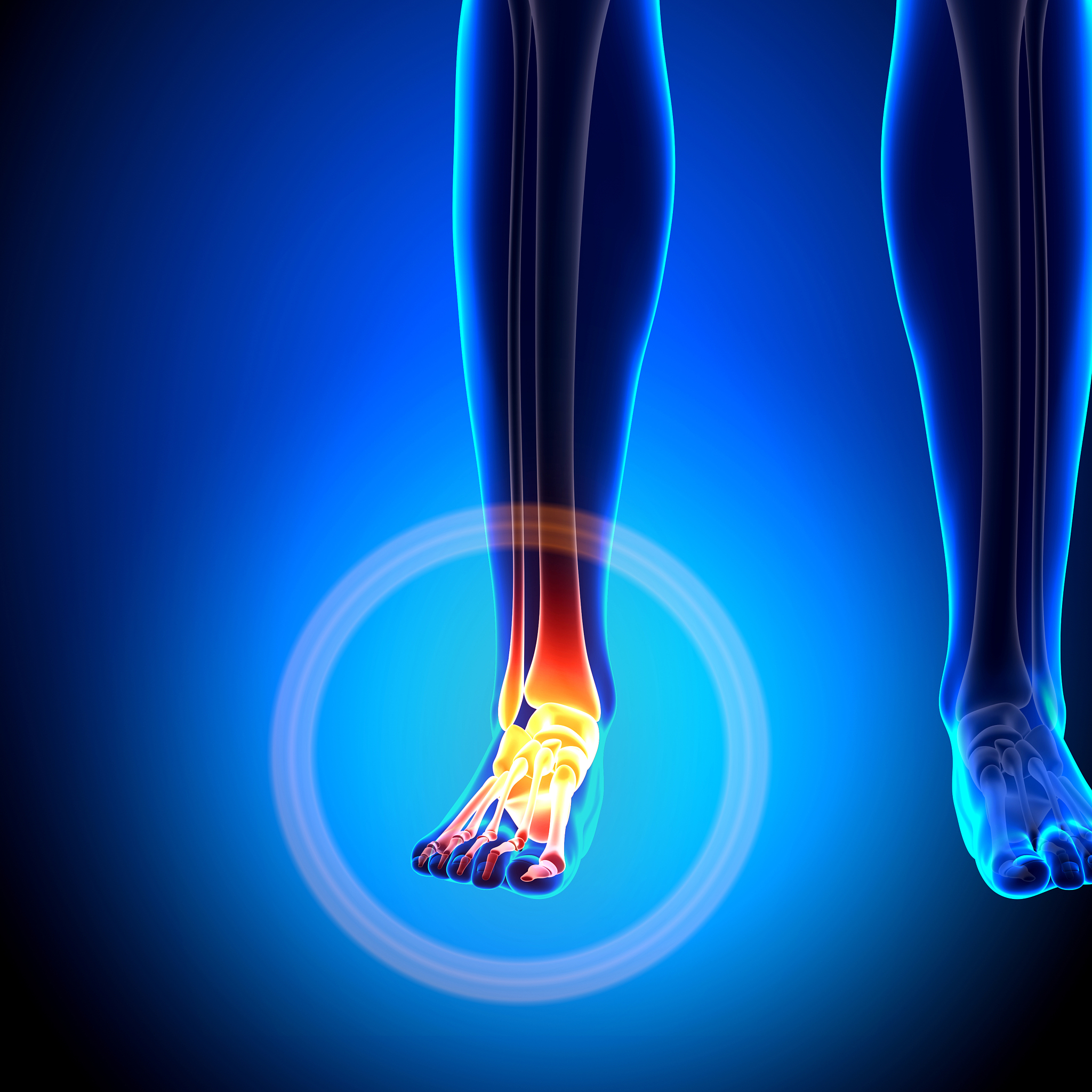 踝关节扭伤：症状、治疗、预防 - 全面指南