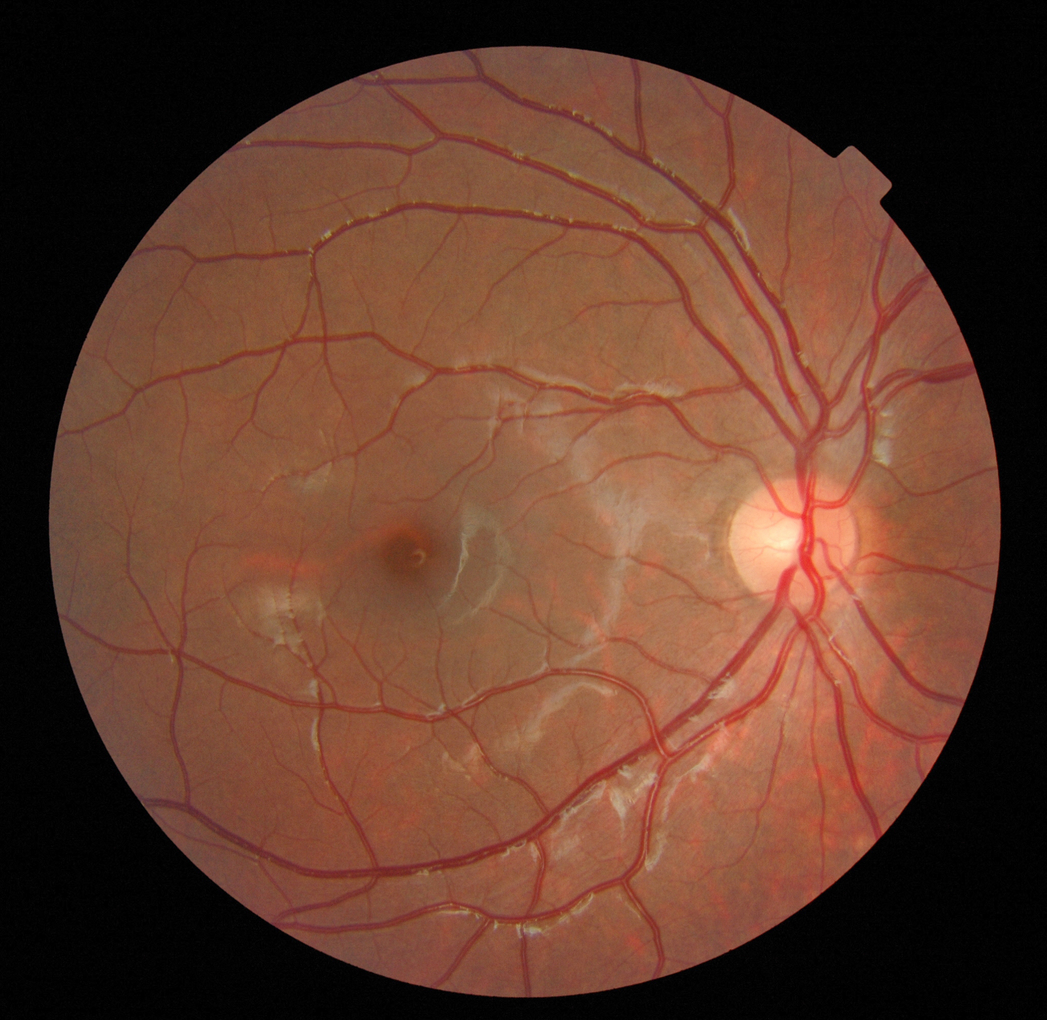 四川省首个视网膜图像技术与慢性血管性疾病防治协同创新中心示范网点成立