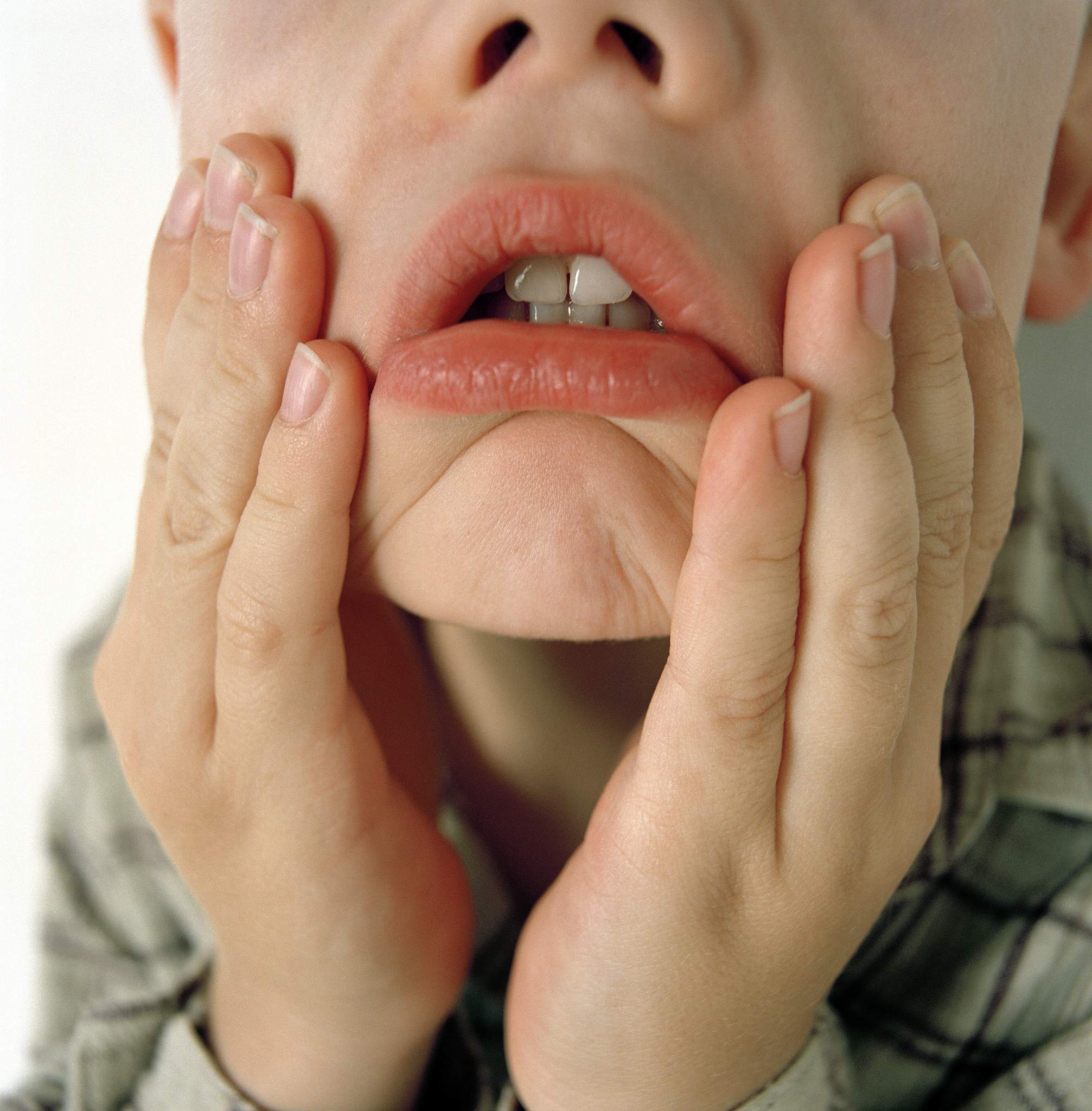 脸色发黄舌苔发白易上火肾阴虚在中医看来是什么症状