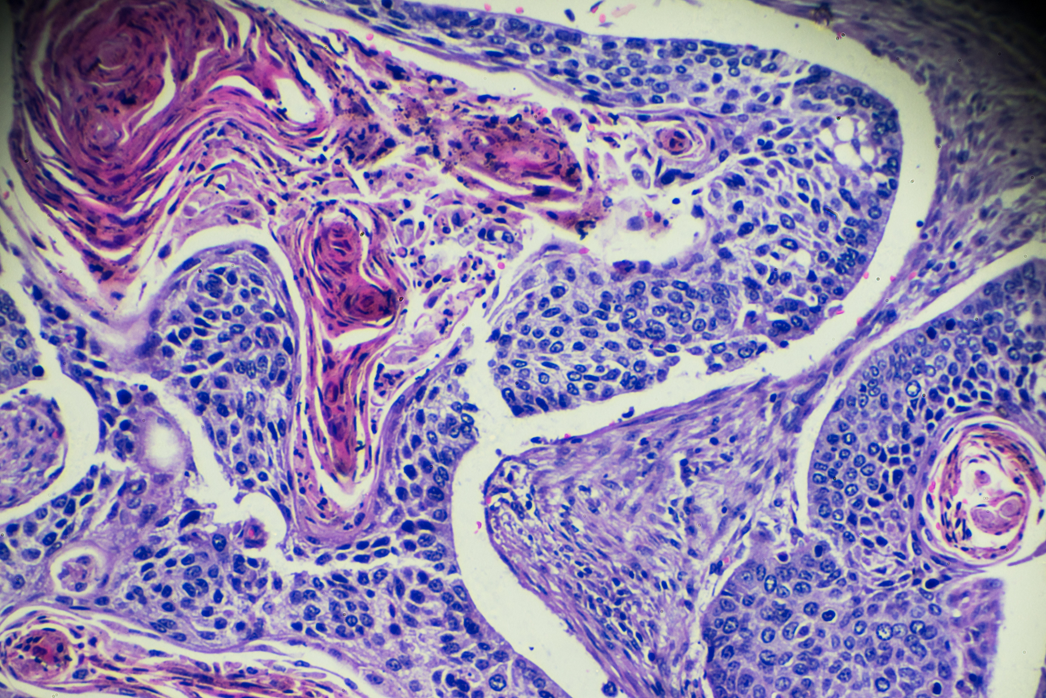 病理学主要学习哪些内容