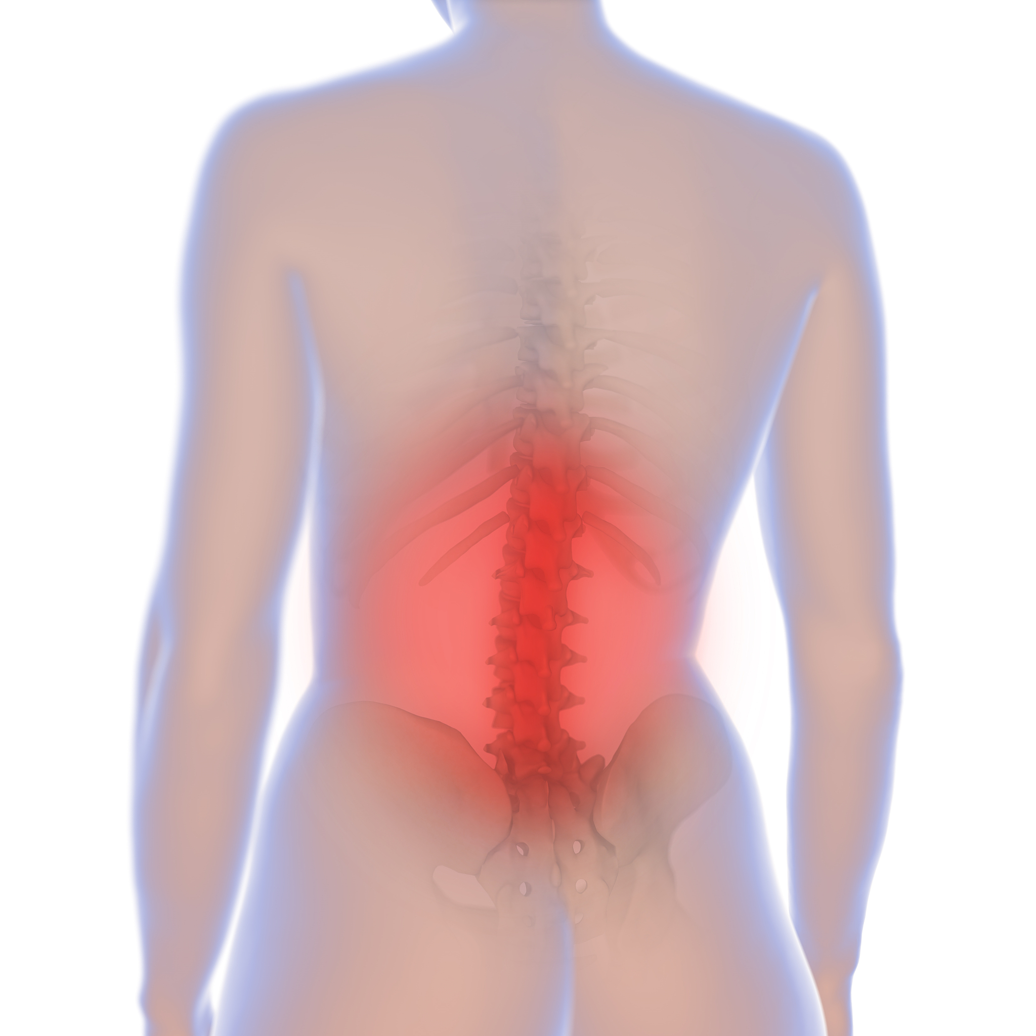 腰椎间盘突出症：年龄、职业、病因及预防