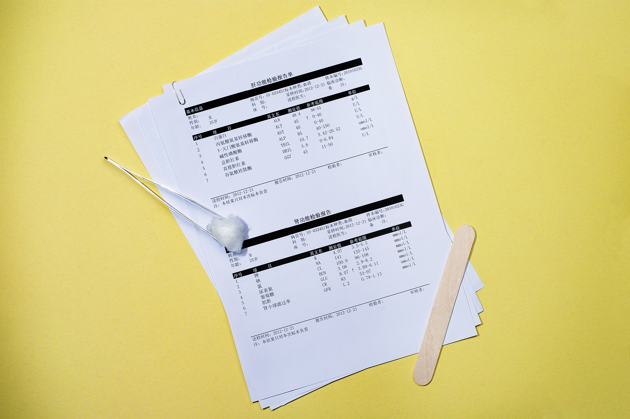 验光单怎么看 REF DATE VD1200 CYLMIX R S C A -125帮我用210字详细描述