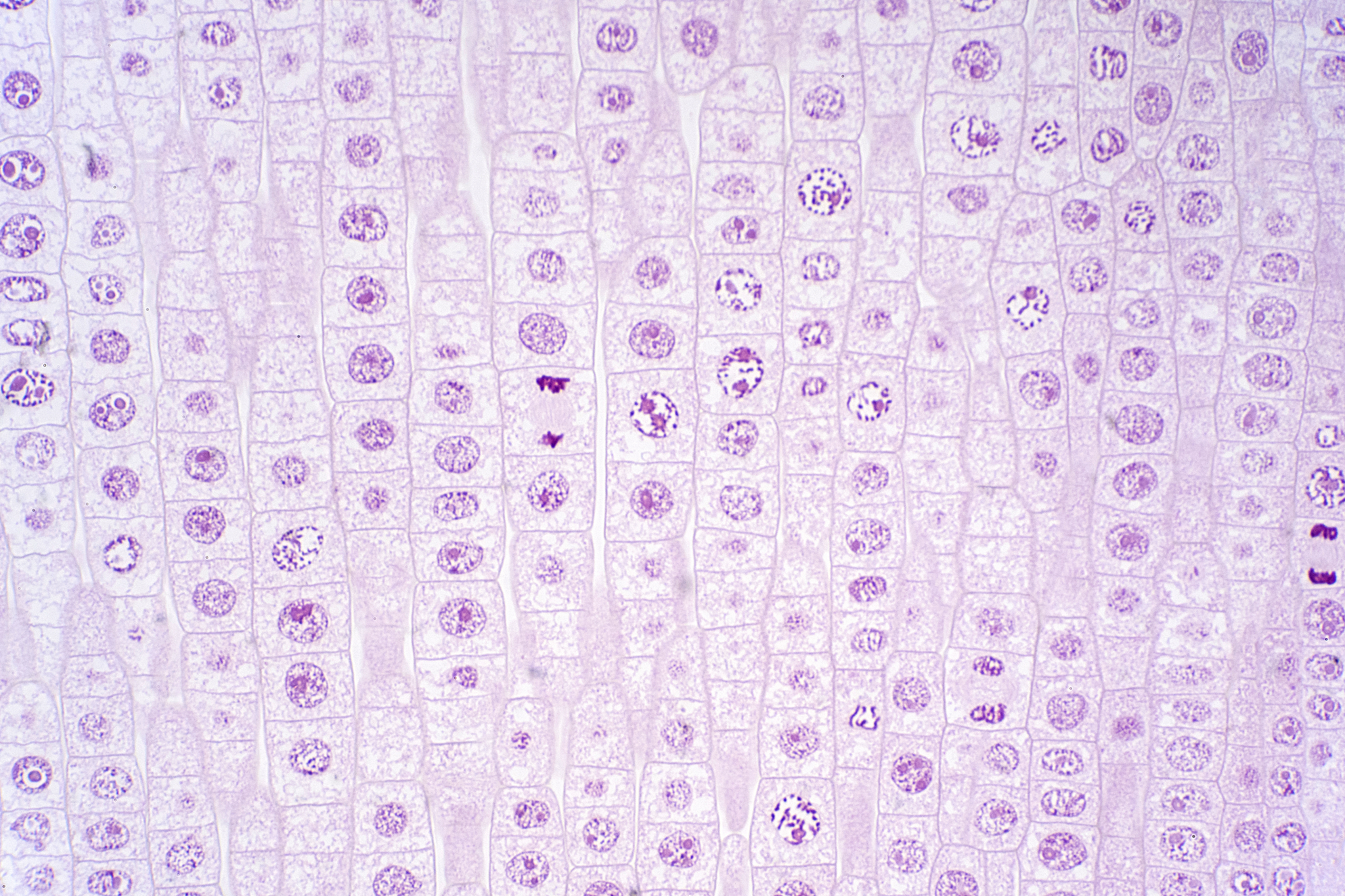 洋葱根尖分生区细胞实验：步骤、方法及观察要点